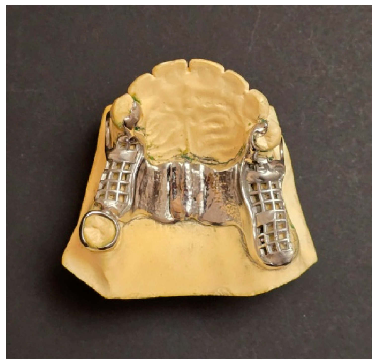 Prosthesis 06 00086 g006 Prosthesis 06 00086 g006