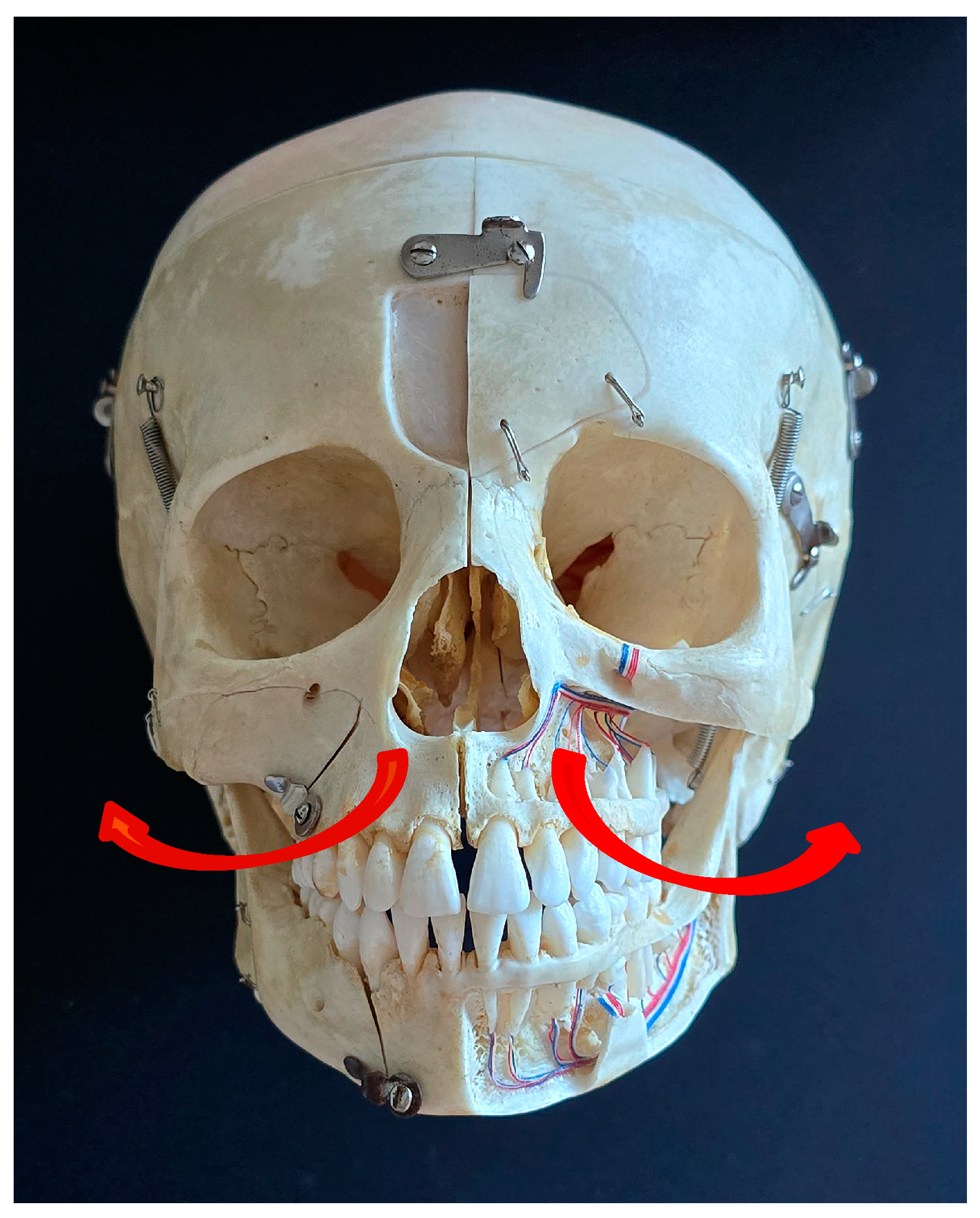Prosthesis 06 00086 g007 Prosthesis 06 00086 g007