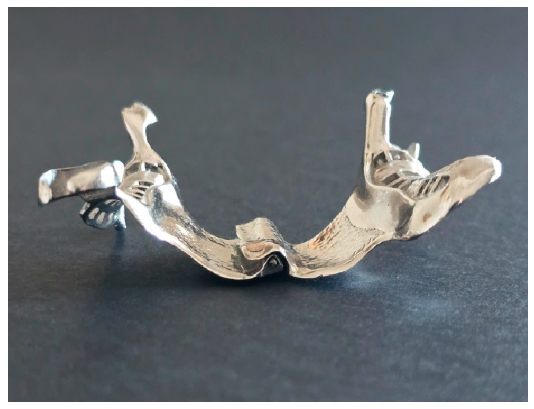 Prosthesis 06 00086 g008 Prosthesis 06 00086 g008