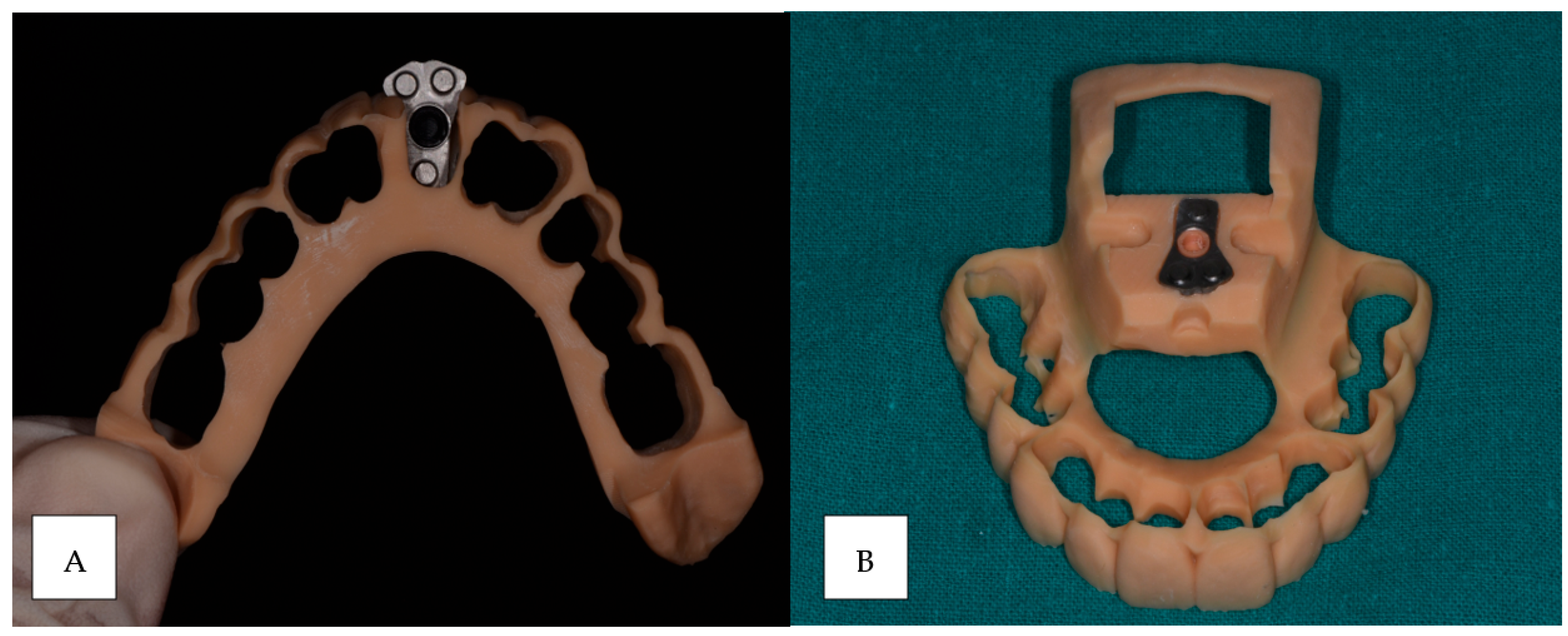 Prosthesis 06 00107 g004 Prosthesis 06 00107 g004