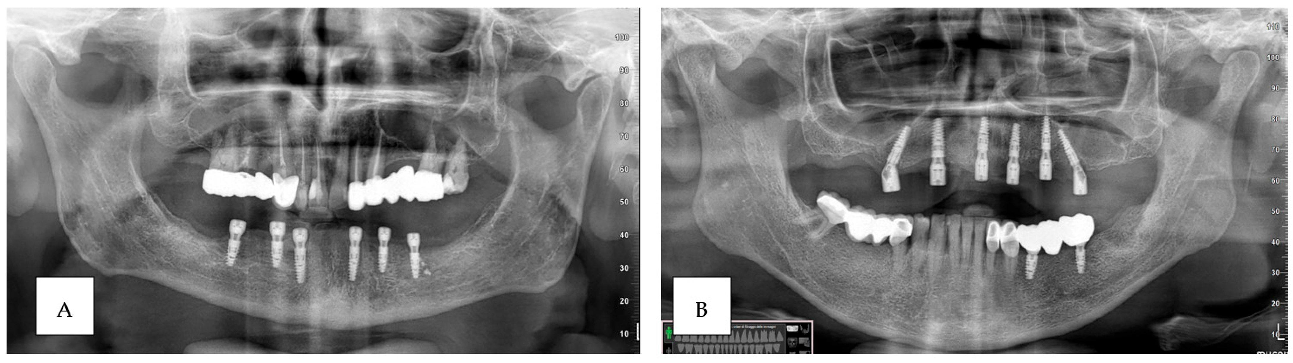 Prosthesis 06 00107 g008 Prosthesis 06 00107 g008