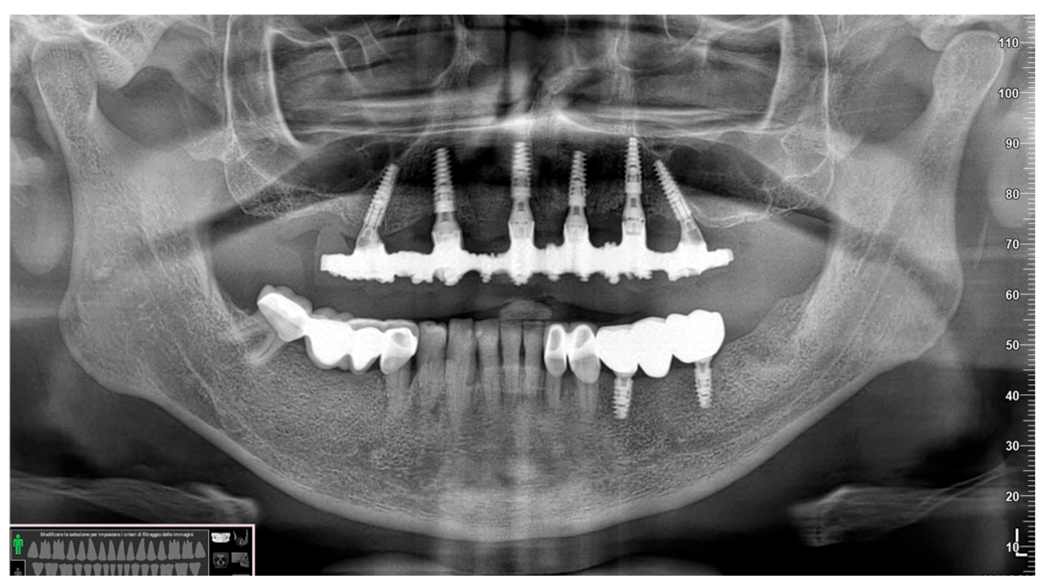 Prosthesis 06 00107 g012 Prosthesis 06 00107 g012