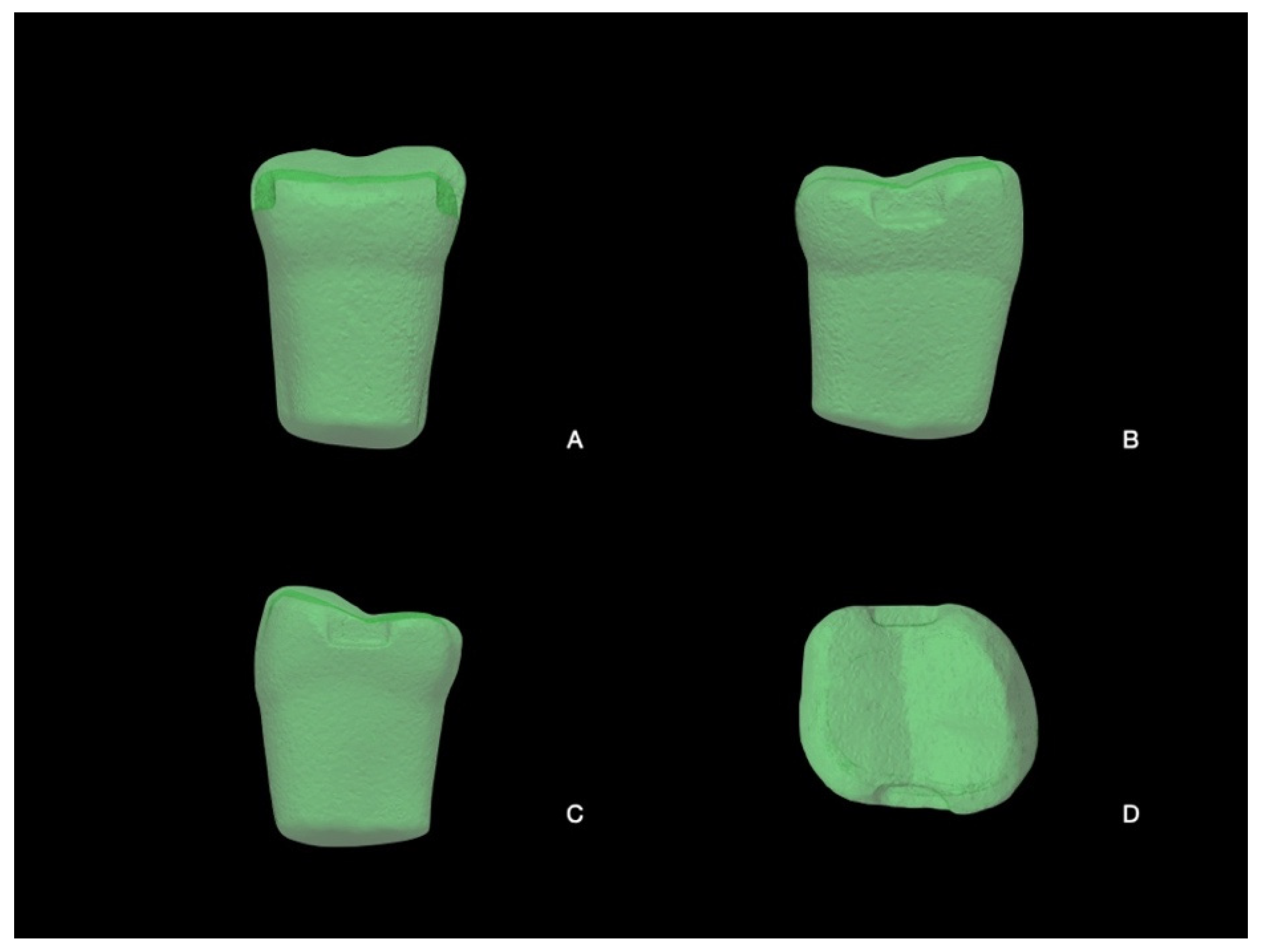 Prosthesis 07 00005 g006 Prosthesis 07 00005 g006