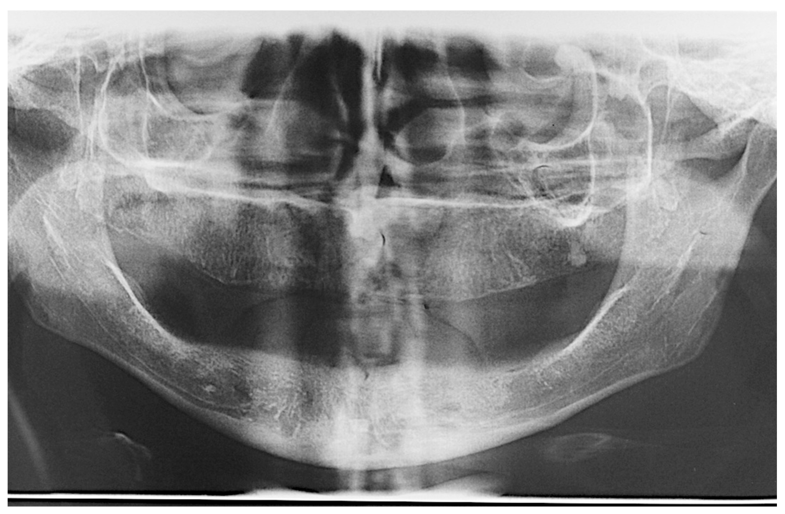 Prosthesis 07 00009 g001