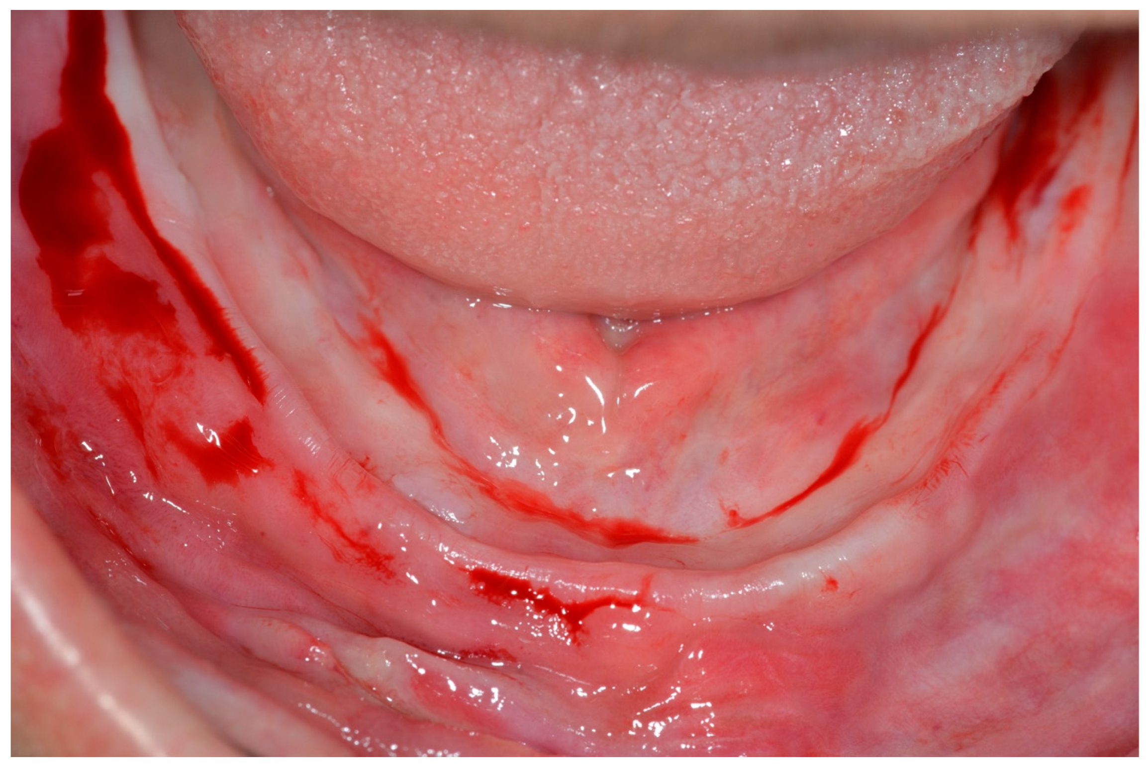 Prosthesis 07 00009 g002