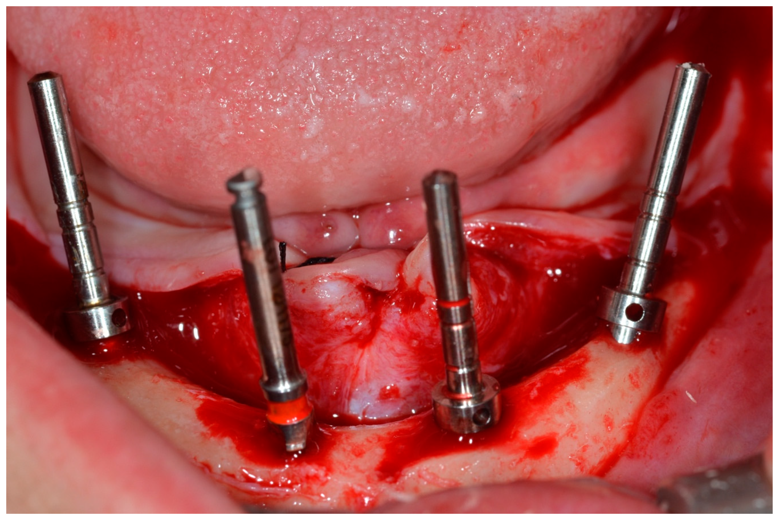 Prosthesis 07 00009 g004