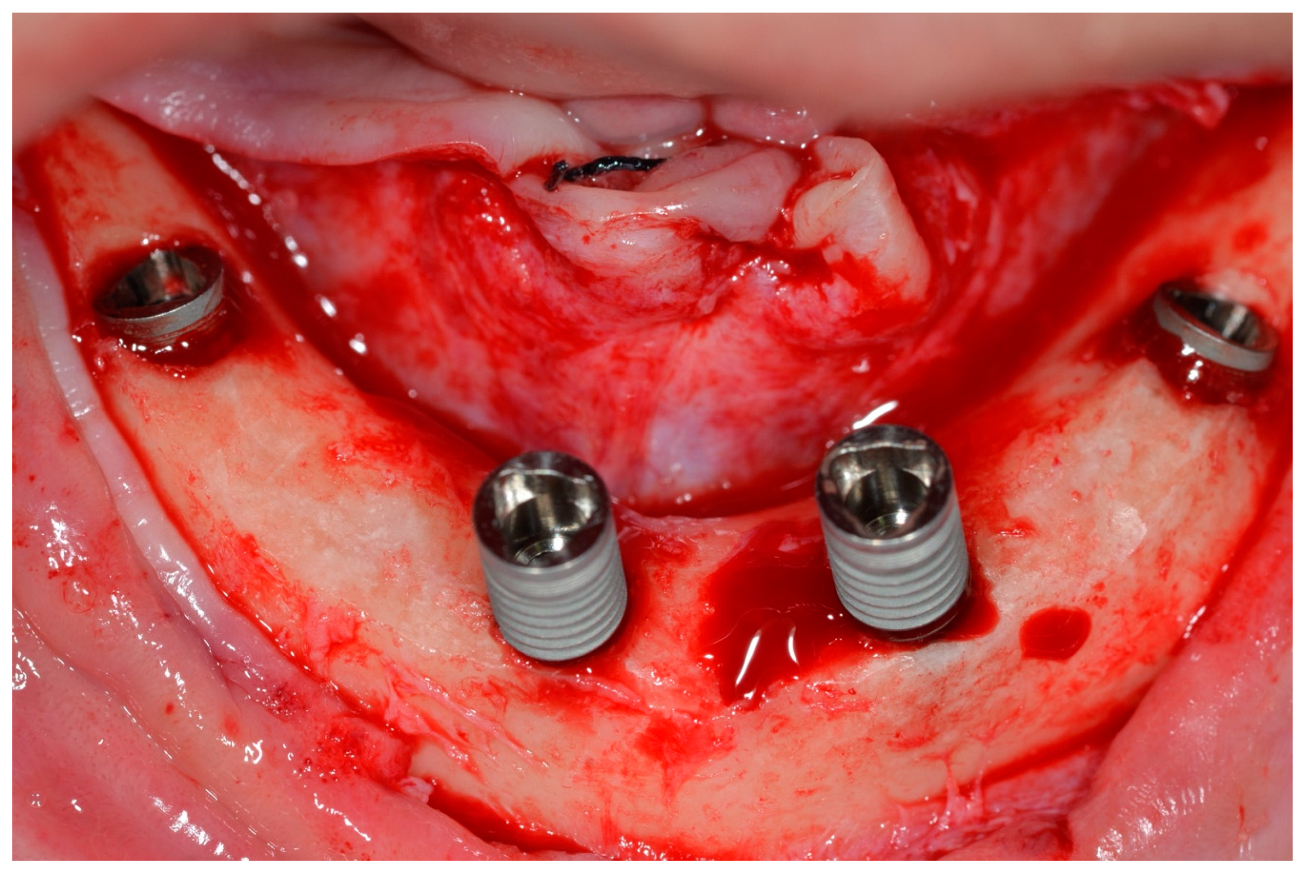 Prosthesis 07 00009 g007