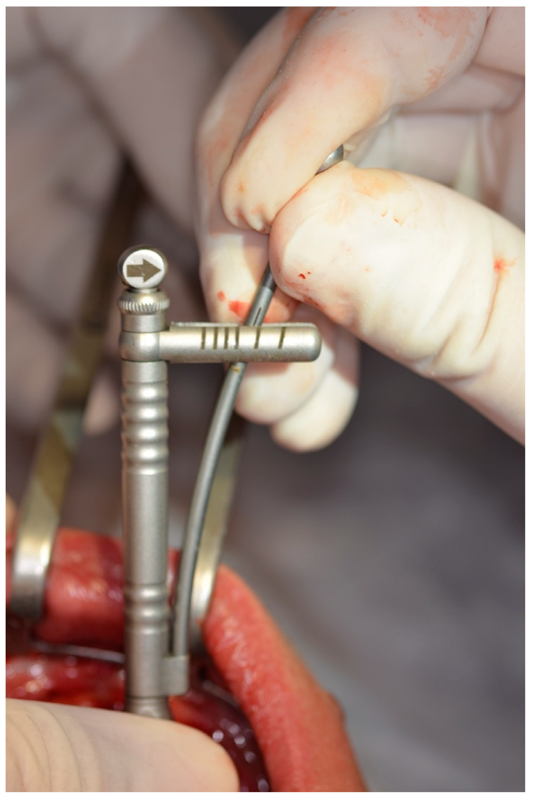 Prosthesis 07 00009 g008