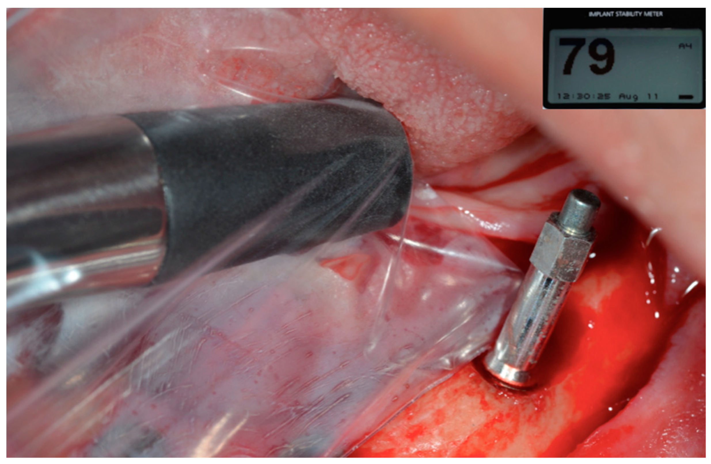 Prosthesis 07 00009 g009