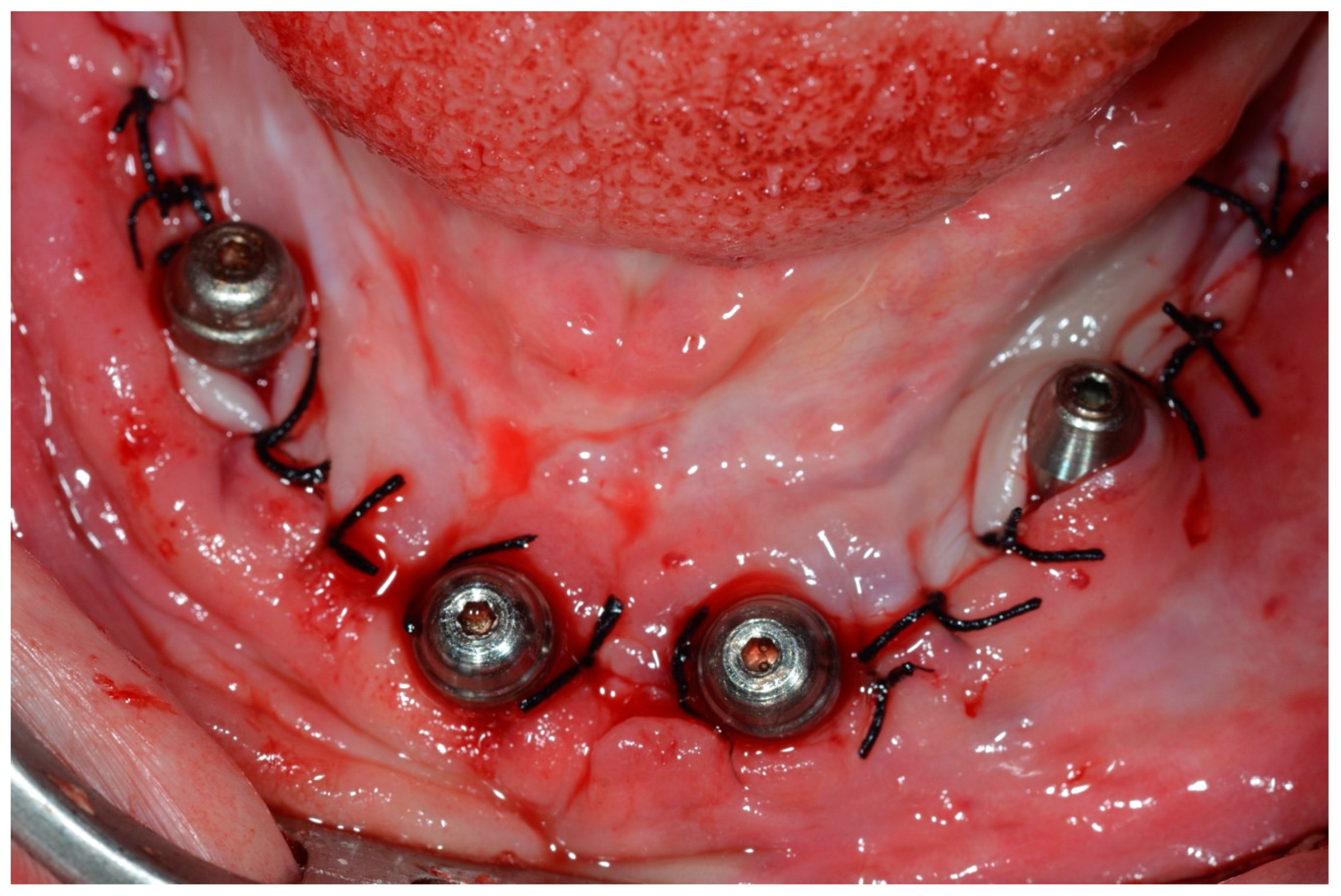 Prosthesis 07 00009 g010