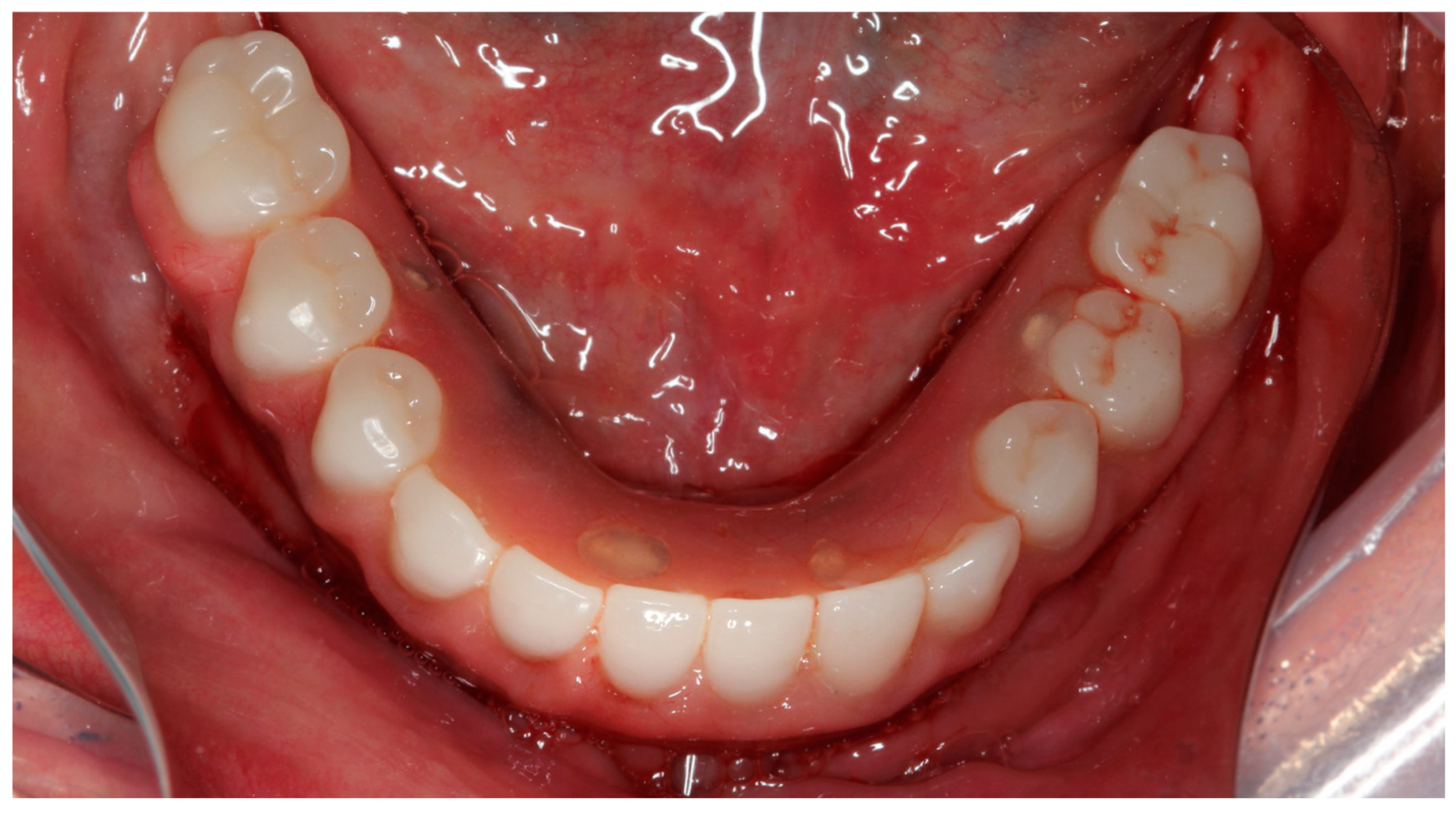 Prosthesis 07 00009 g011