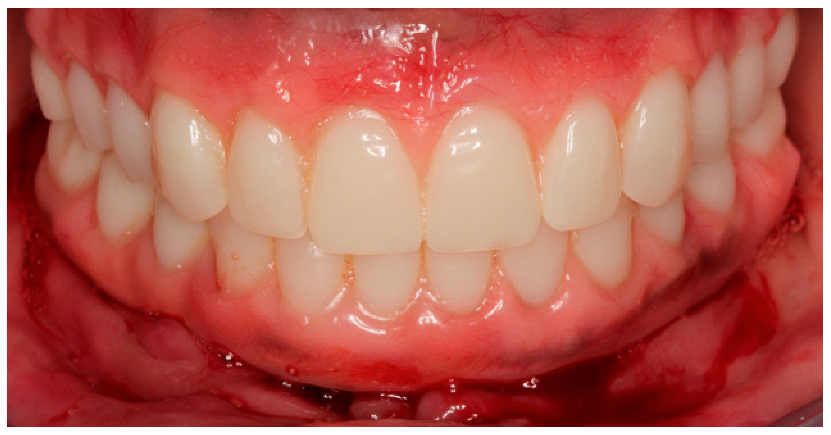 Prosthesis 07 00009 g012