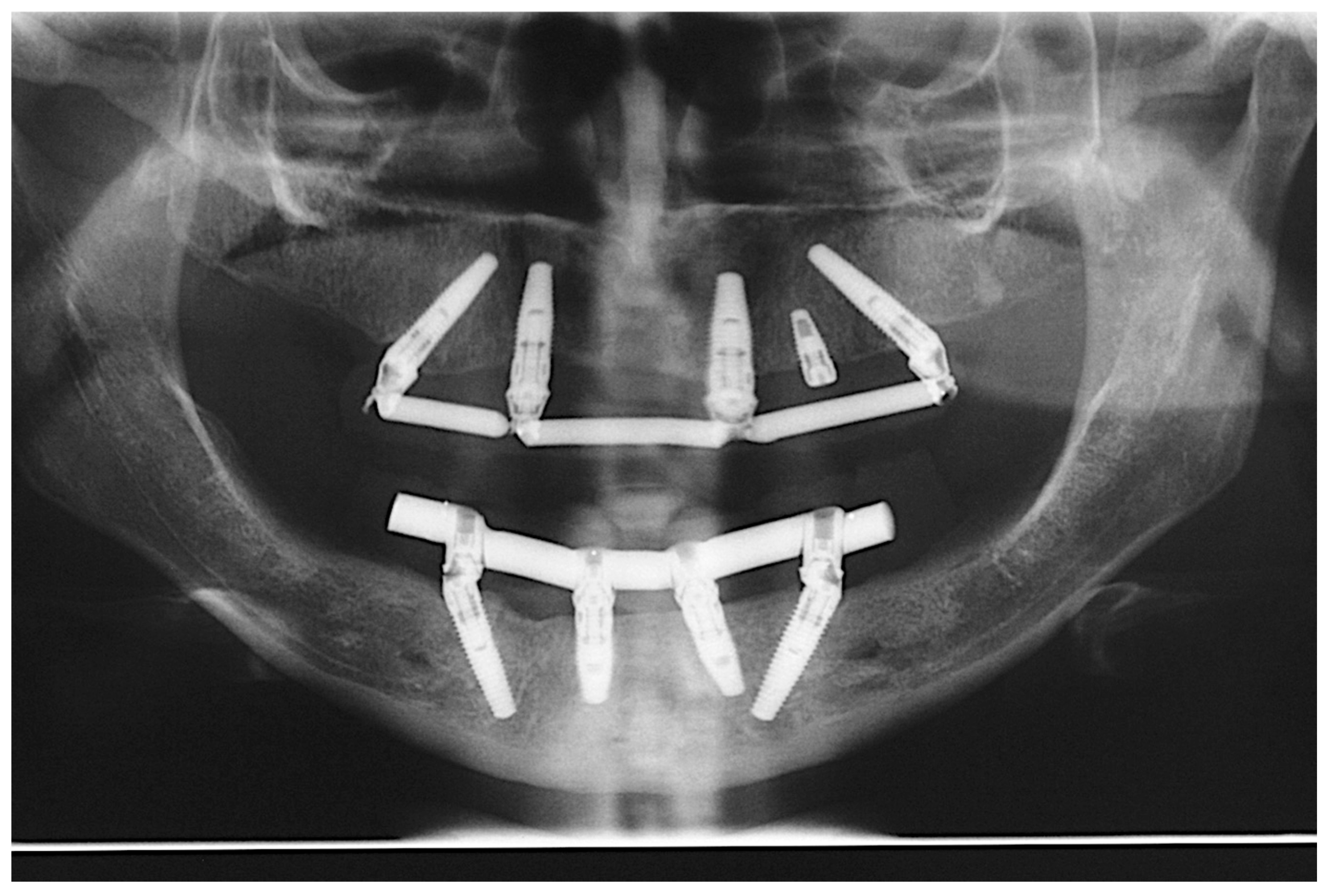 Prosthesis 07 00009 g013