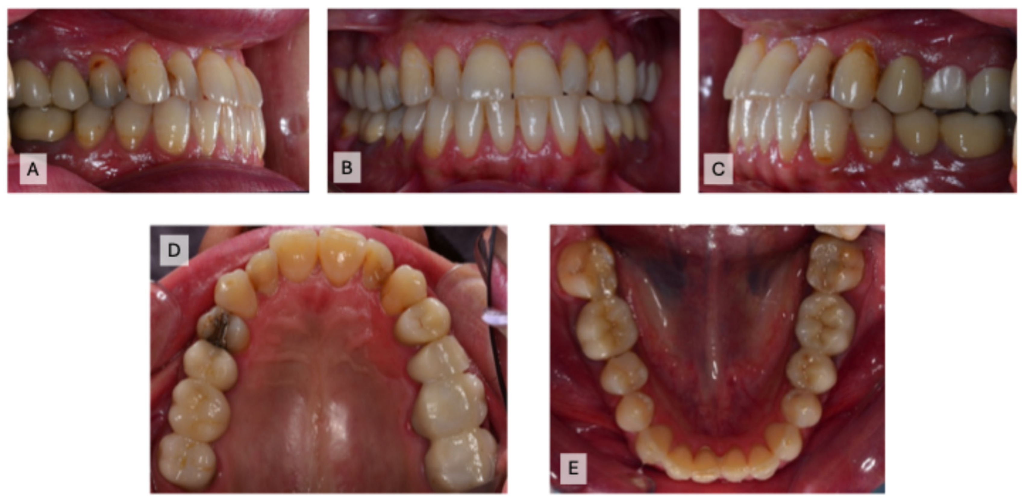 Prosthesis 07 00023 g001