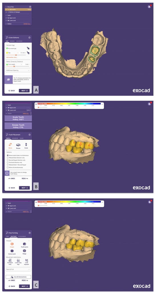 Prosthesis 07 00023 g006