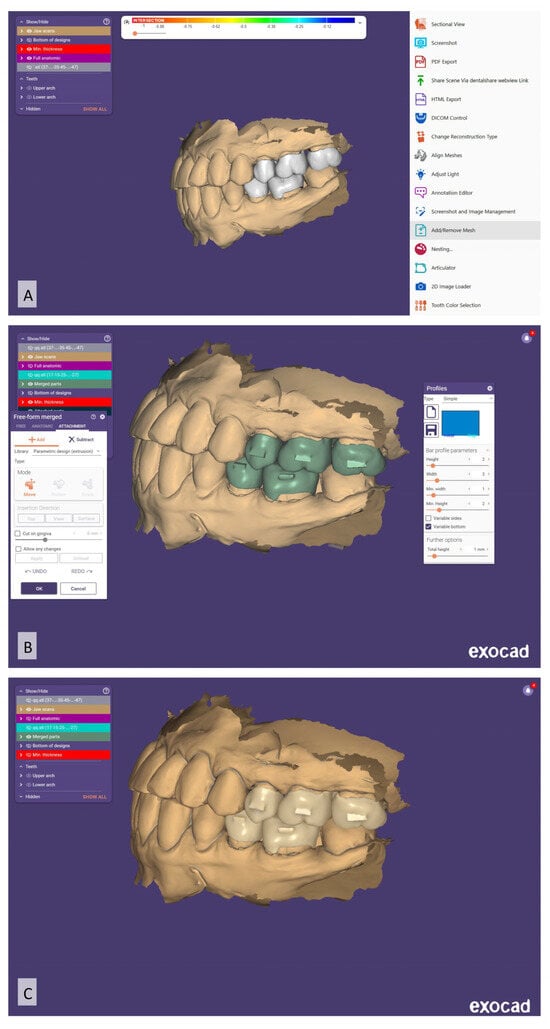 Prosthesis 07 00023 g007
