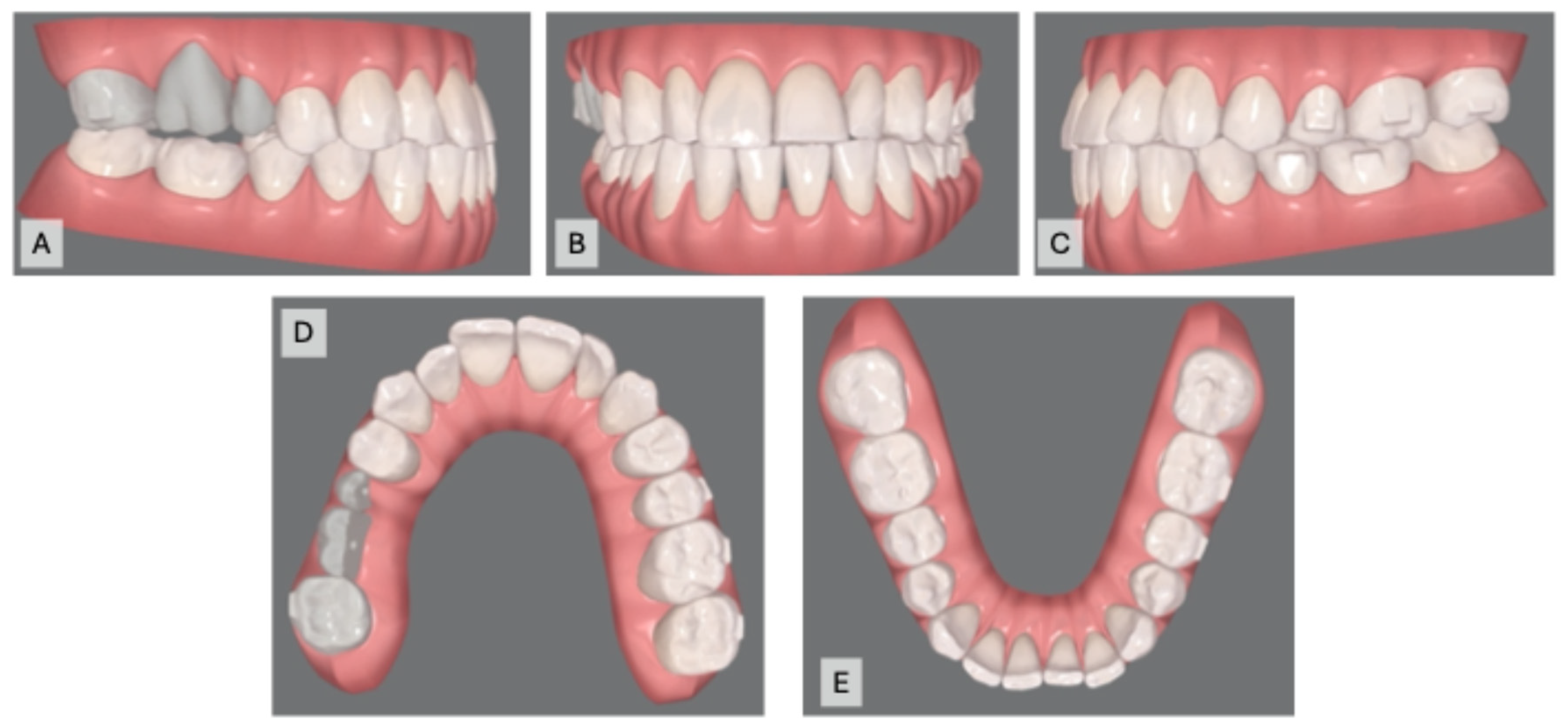 Prosthesis 07 00023 g009