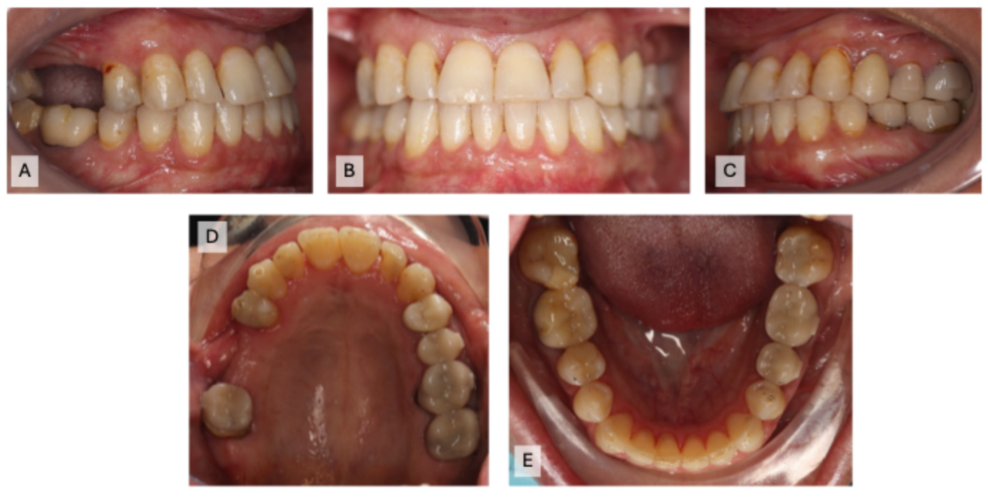 Prosthesis 07 00023 g010