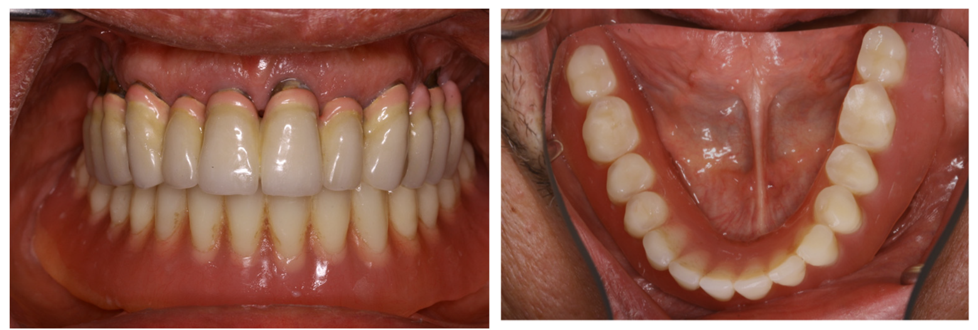 Prosthesis 07 00025 g001 Prosthesis 07 00025 g001