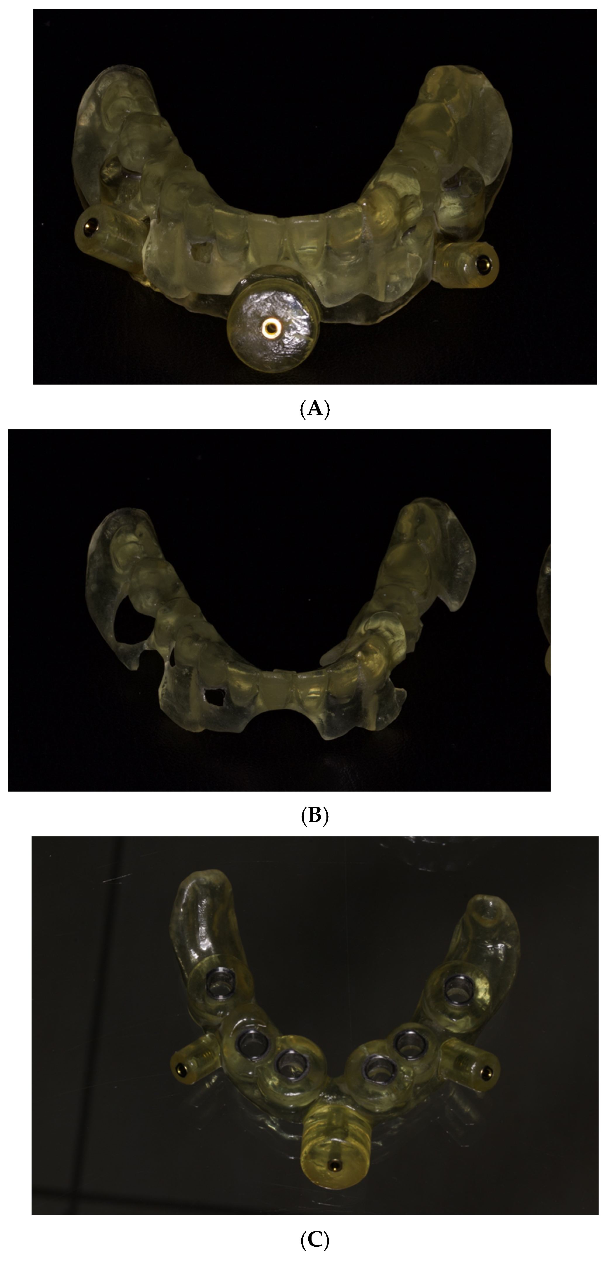 Prosthesis 07 00025 g004 Prosthesis 07 00025 g004