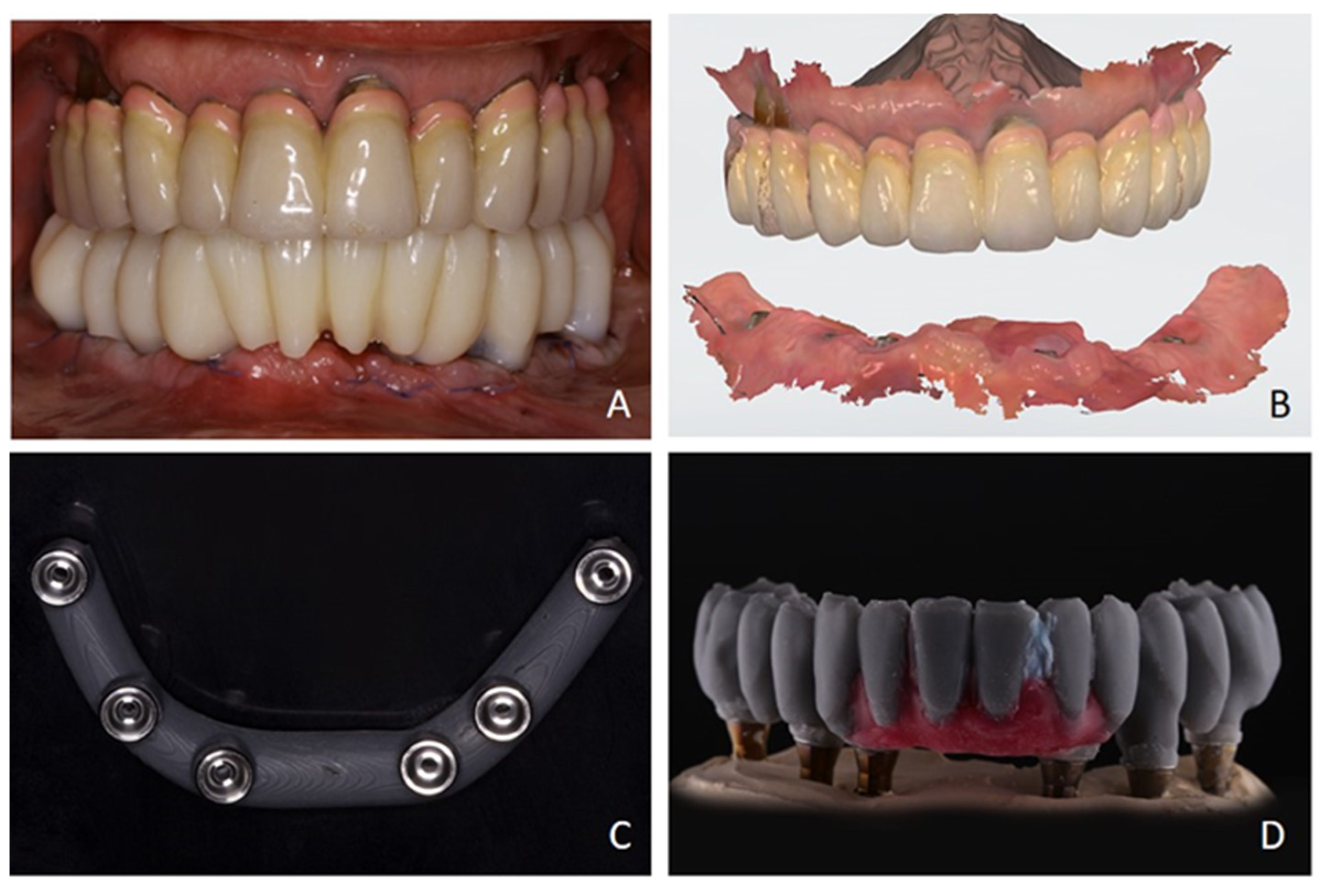 Prosthesis 07 00025 g006 Prosthesis 07 00025 g006