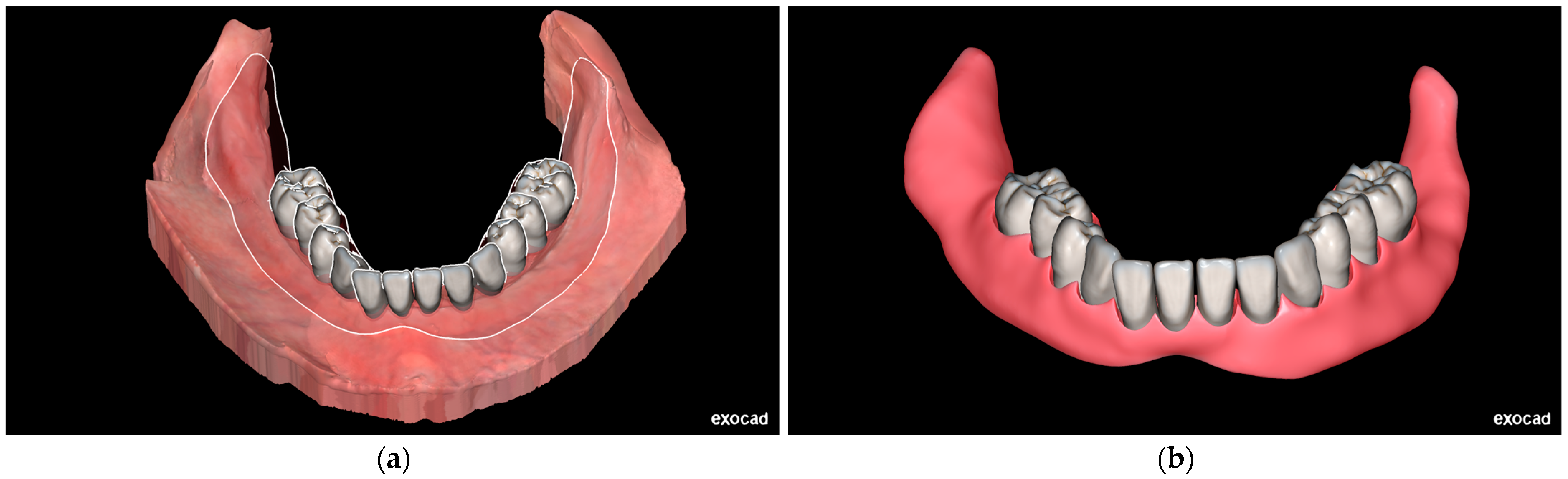 Prosthesis 07 00029 g004
