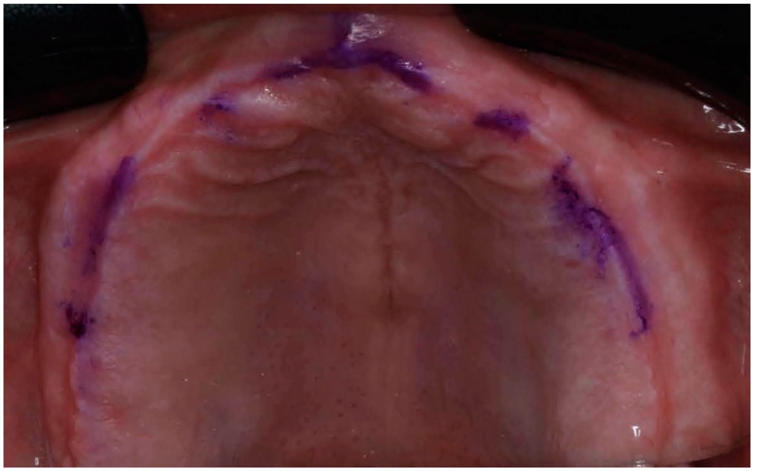 Prosthesis 07 00037 g004