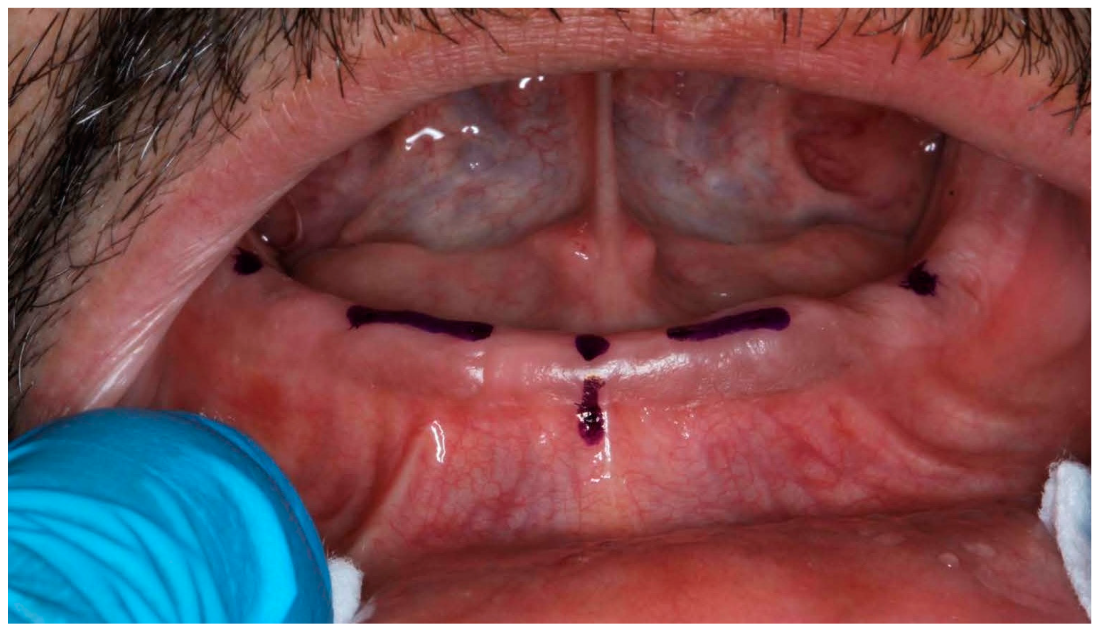 Prosthesis 07 00037 g005