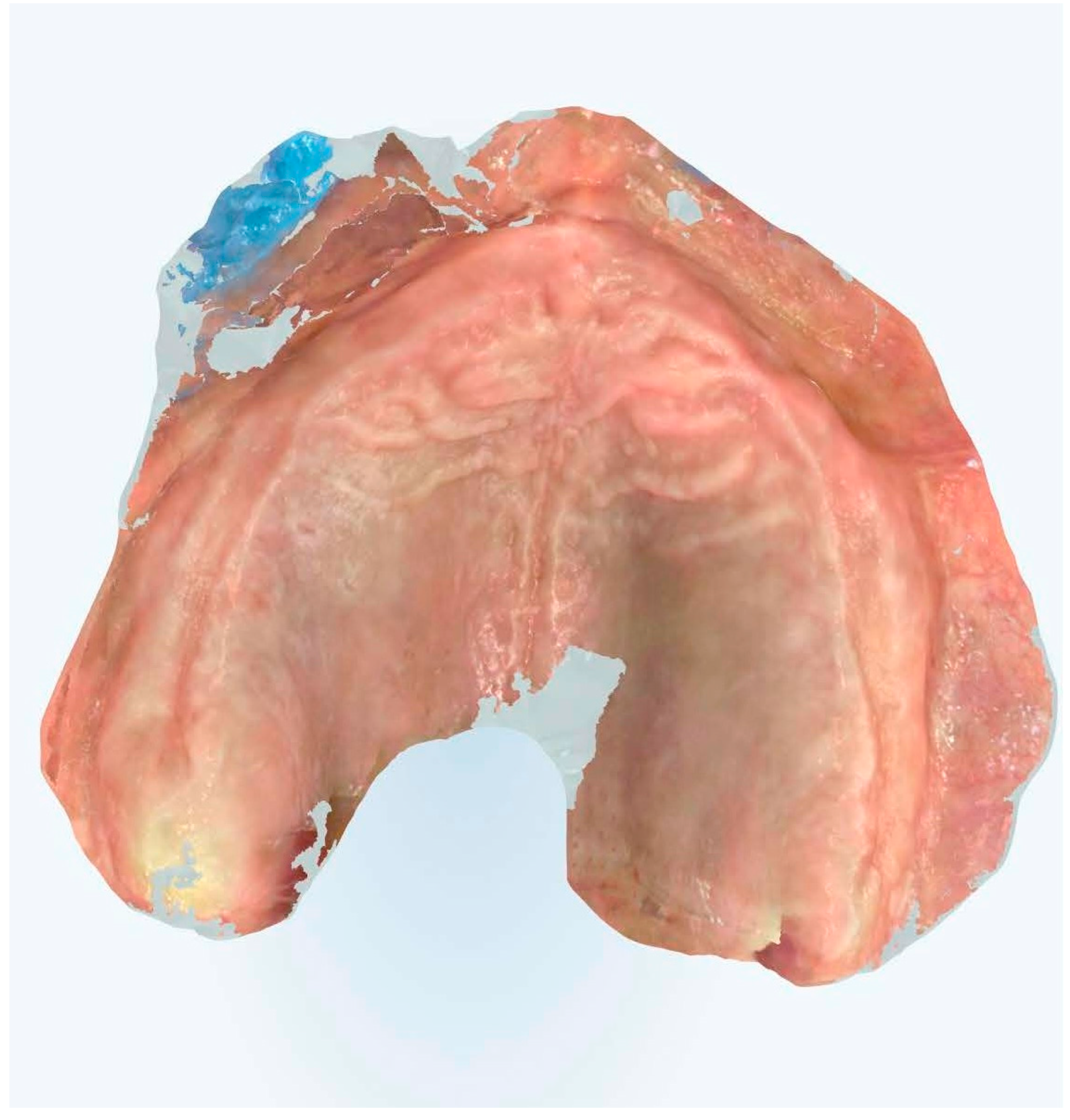 Prosthesis 07 00037 g007