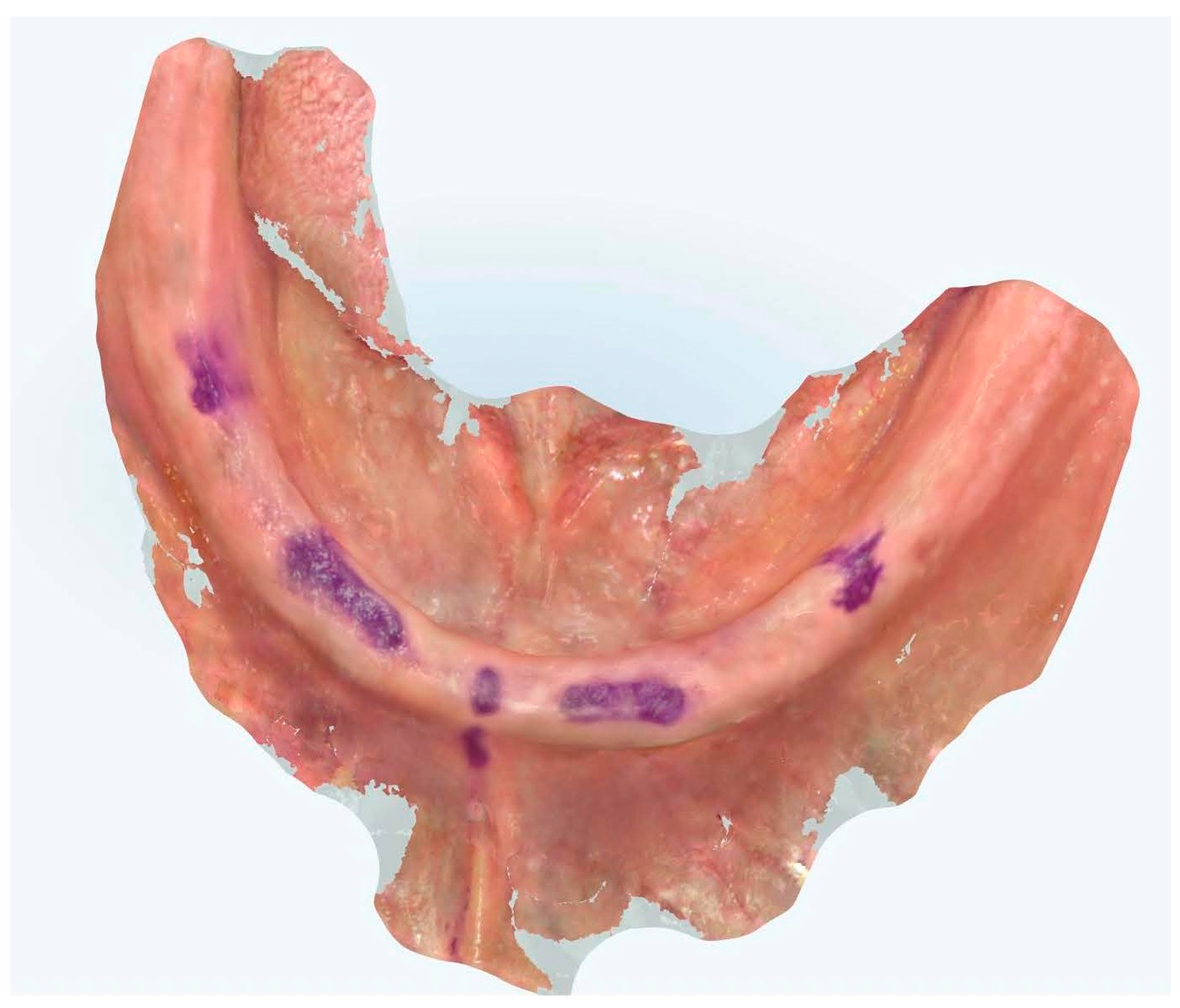 Prosthesis 07 00037 g010