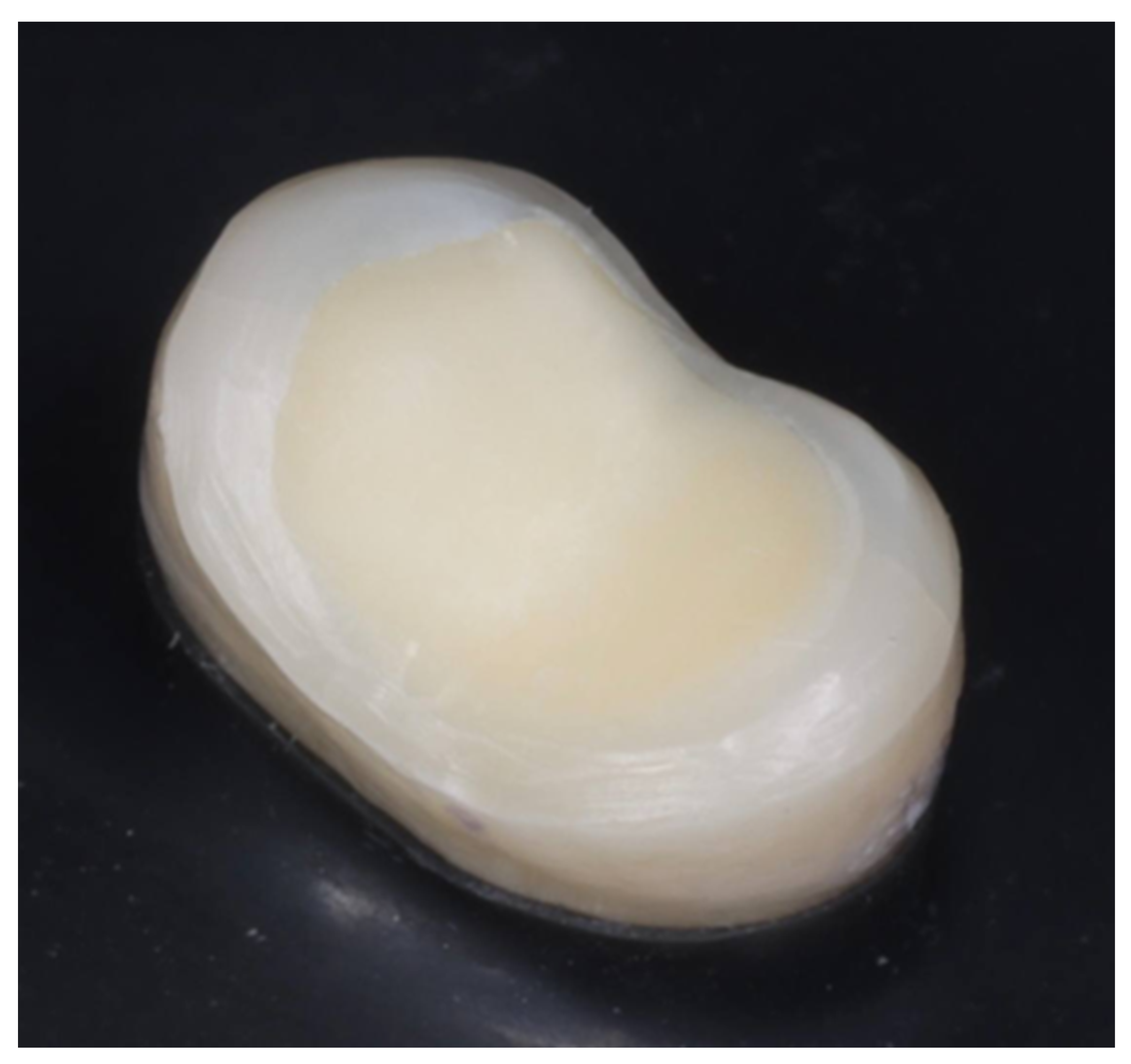 Prosthesis 07 00055 g001 Prosthesis 07 00055 g001