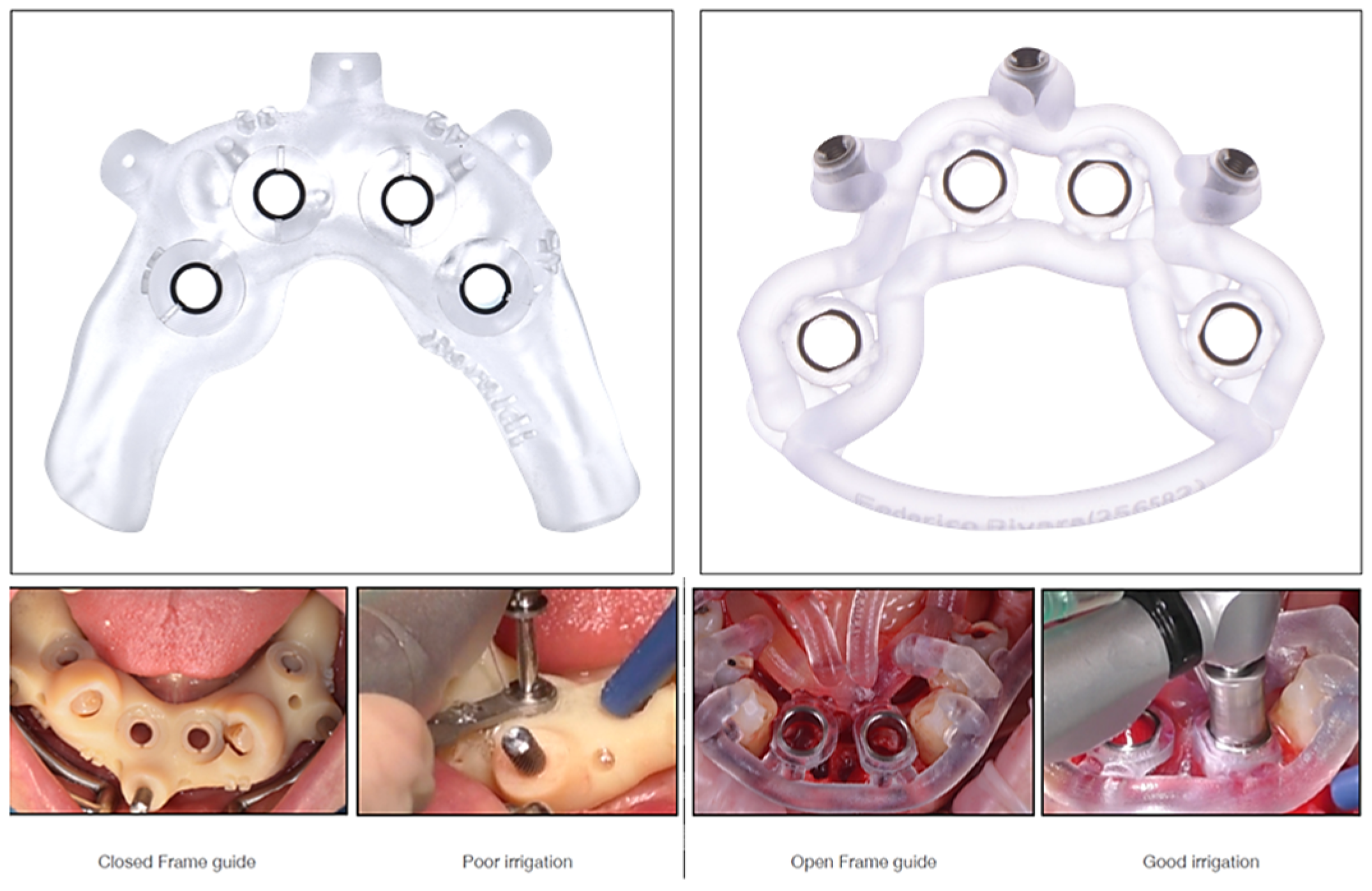 Prosthesis 07 00076 g001 Prosthesis 07 00076 g001