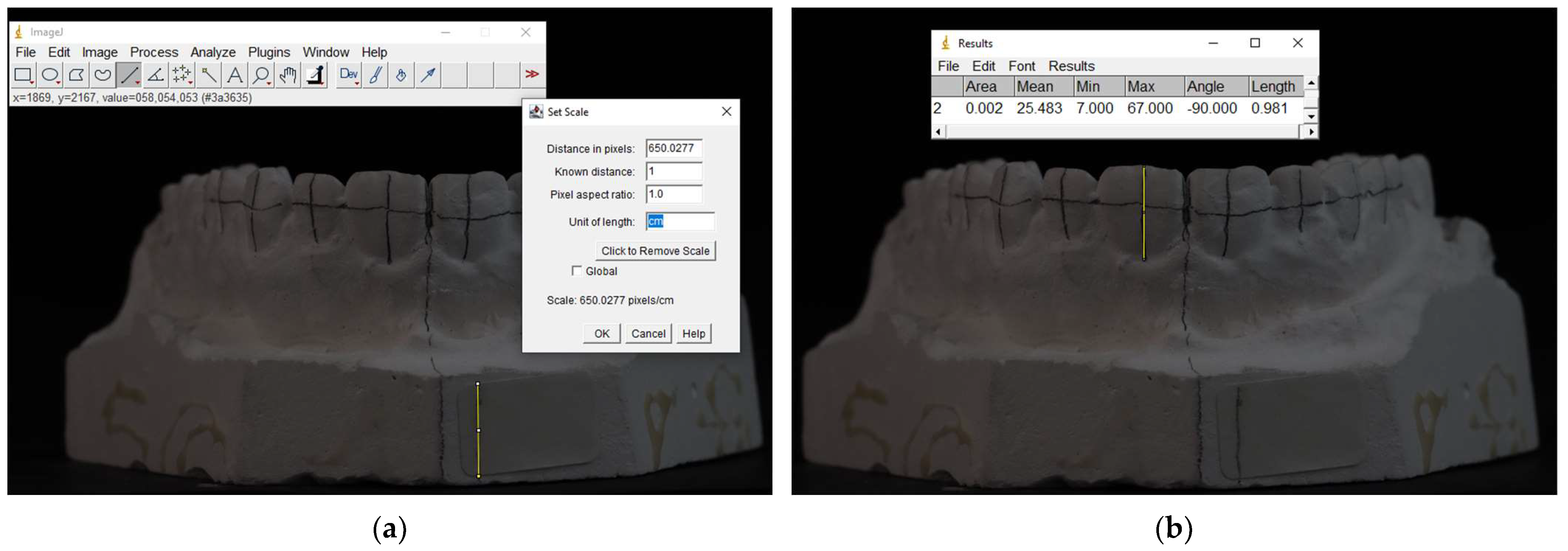 Prosthesis 07 00077 g002