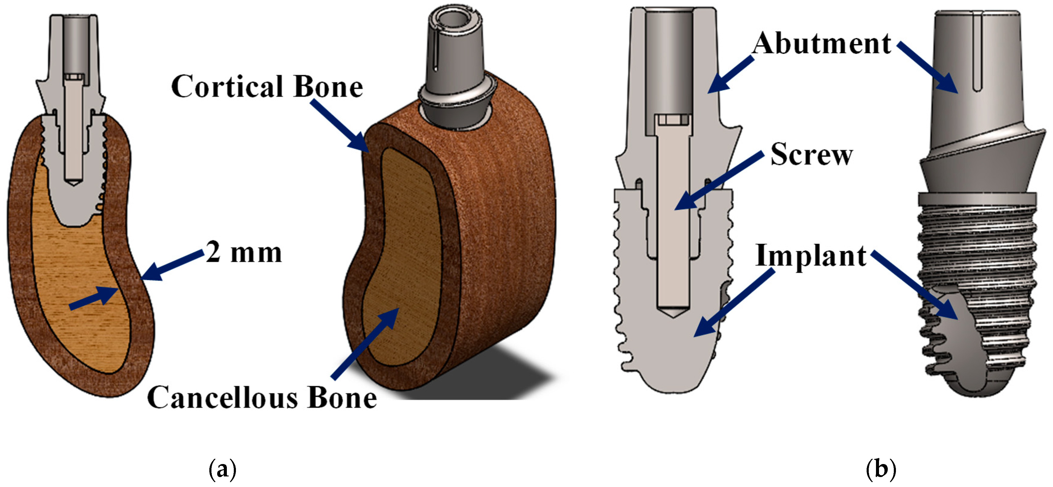 Prosthesis 07 00093 g001 Prosthesis 07 00093 g001