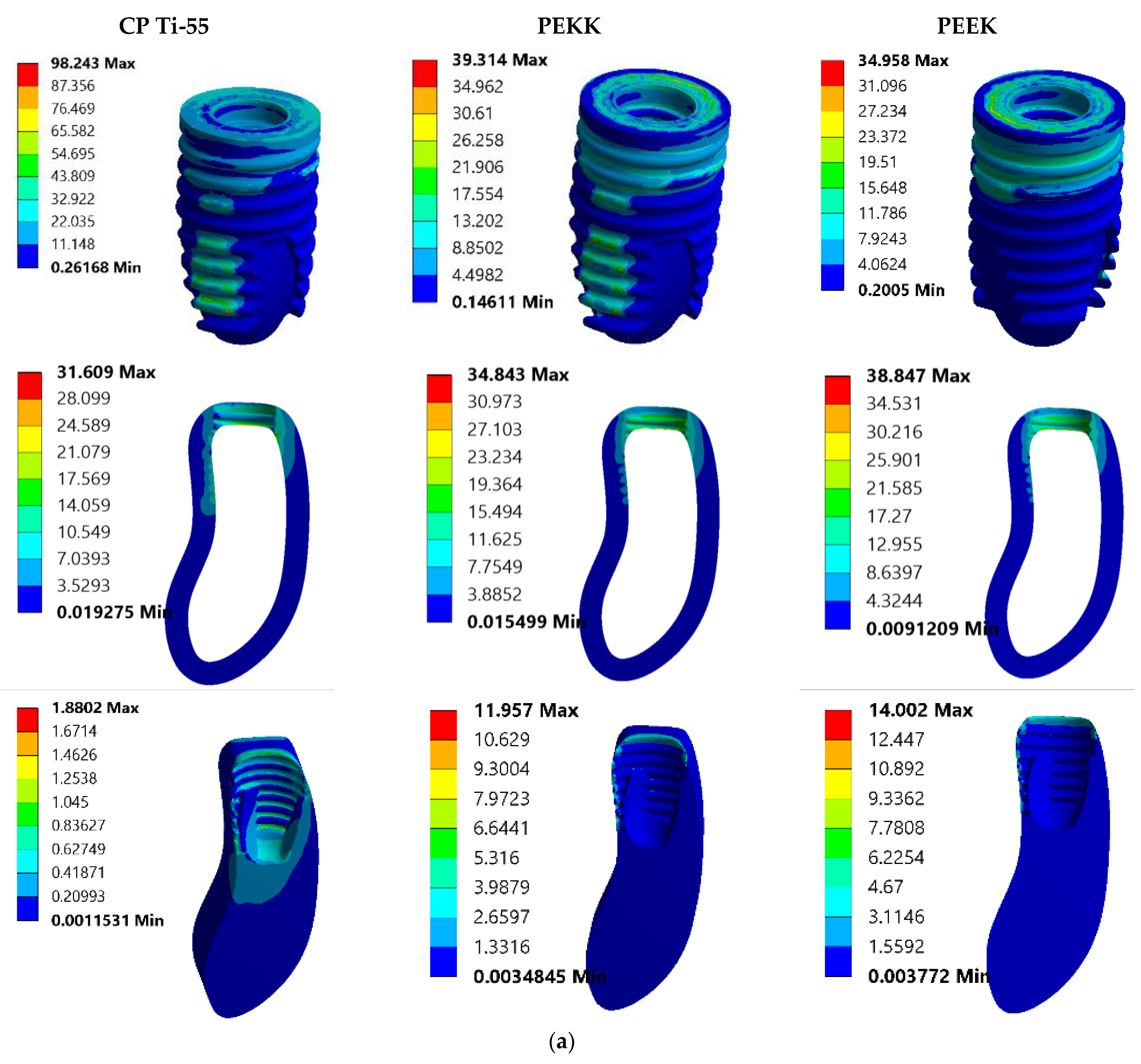 Prosthesis 07 00093 g003a Prosthesis 07 00093 g003a