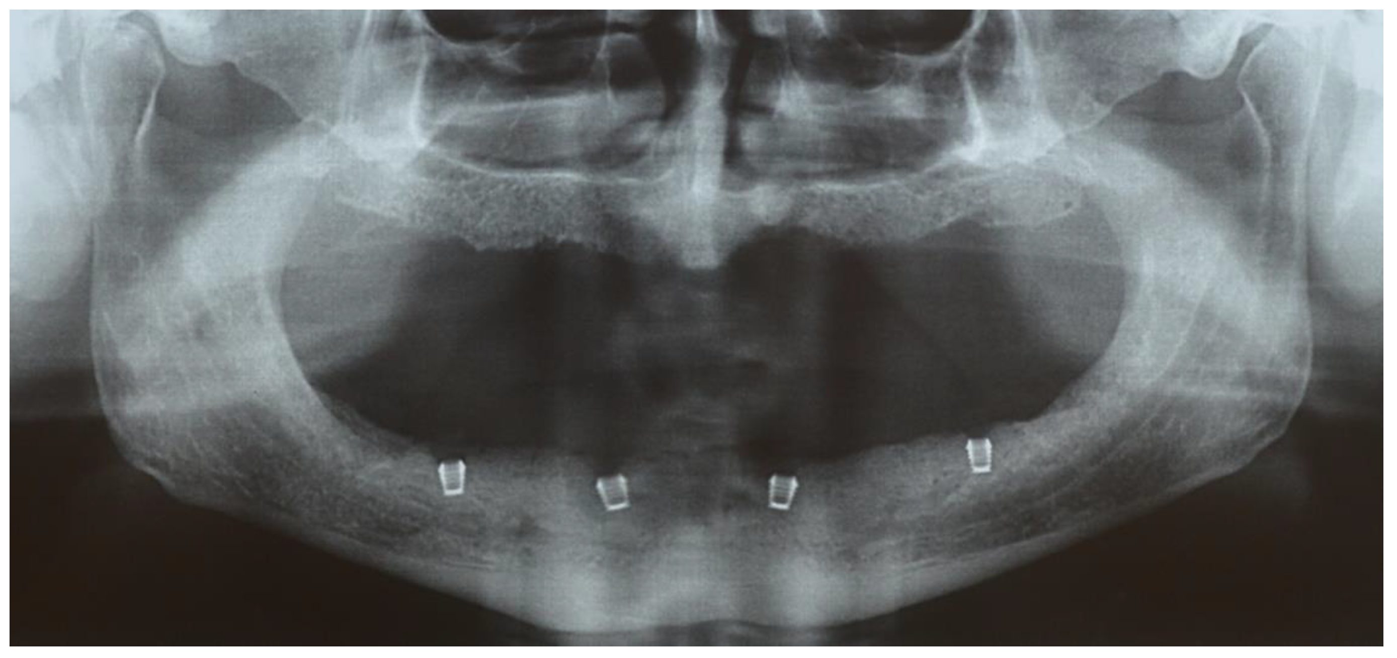 Prosthesis 07 00094 g001 Prosthesis 07 00094 g001