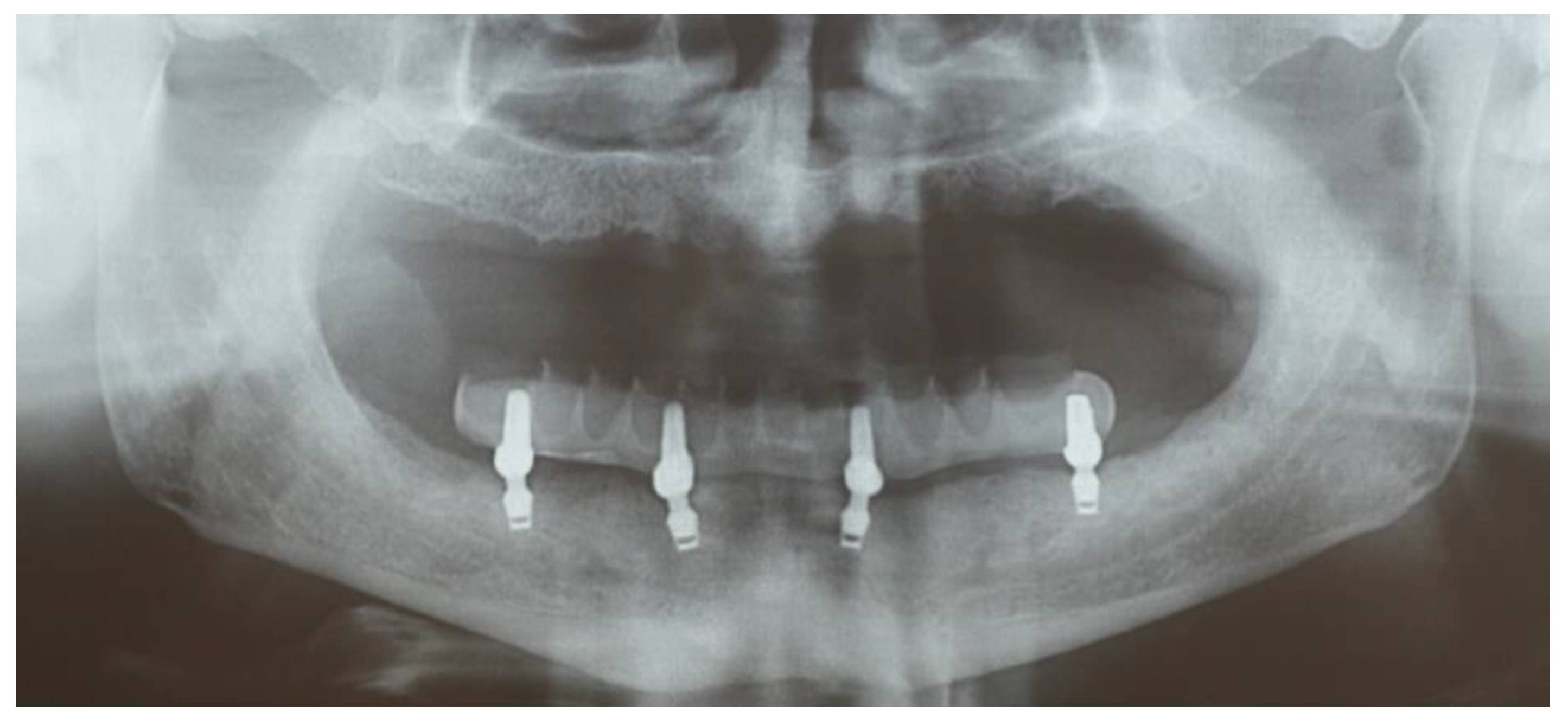 Prosthesis 07 00094 g004 Prosthesis 07 00094 g004
