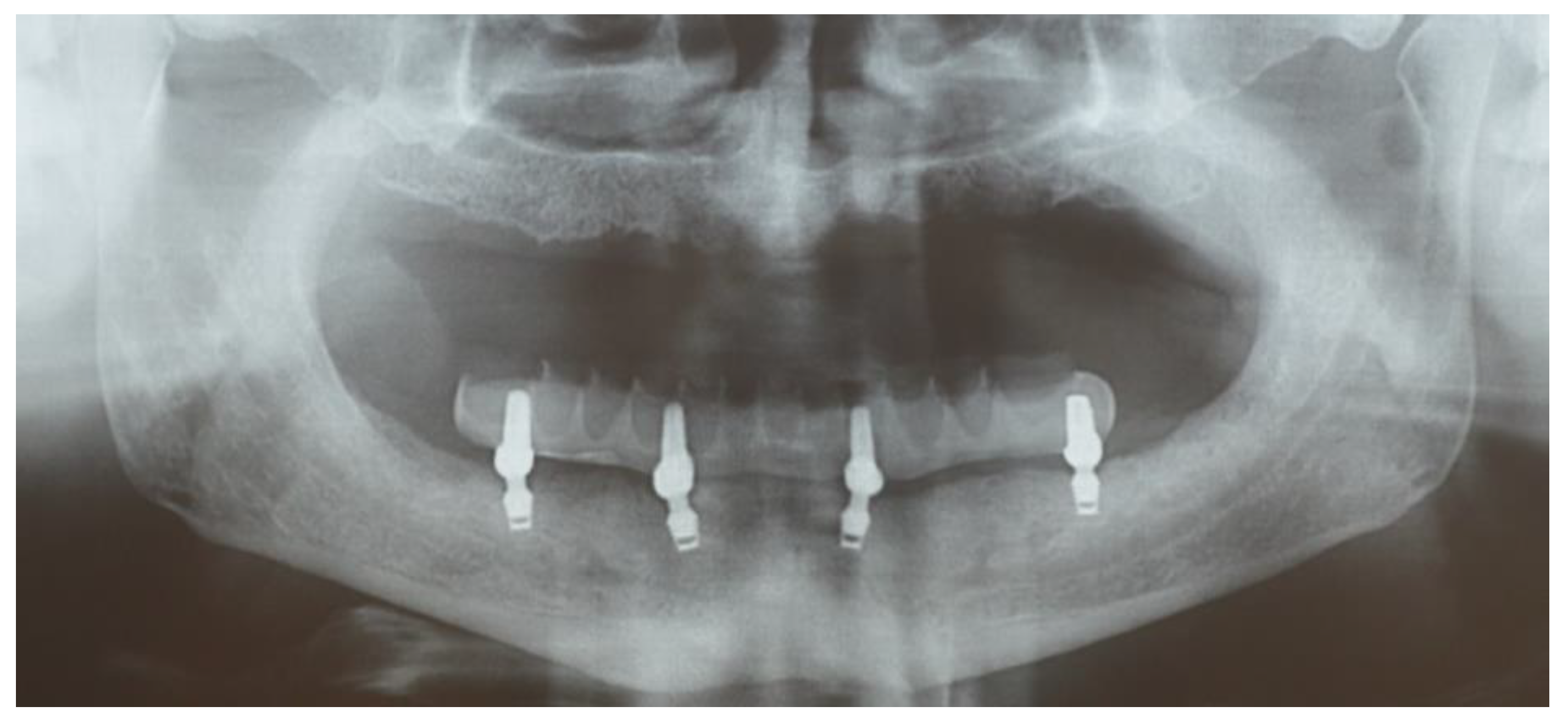 Prosthesis 07 00094 g006 Prosthesis 07 00094 g006