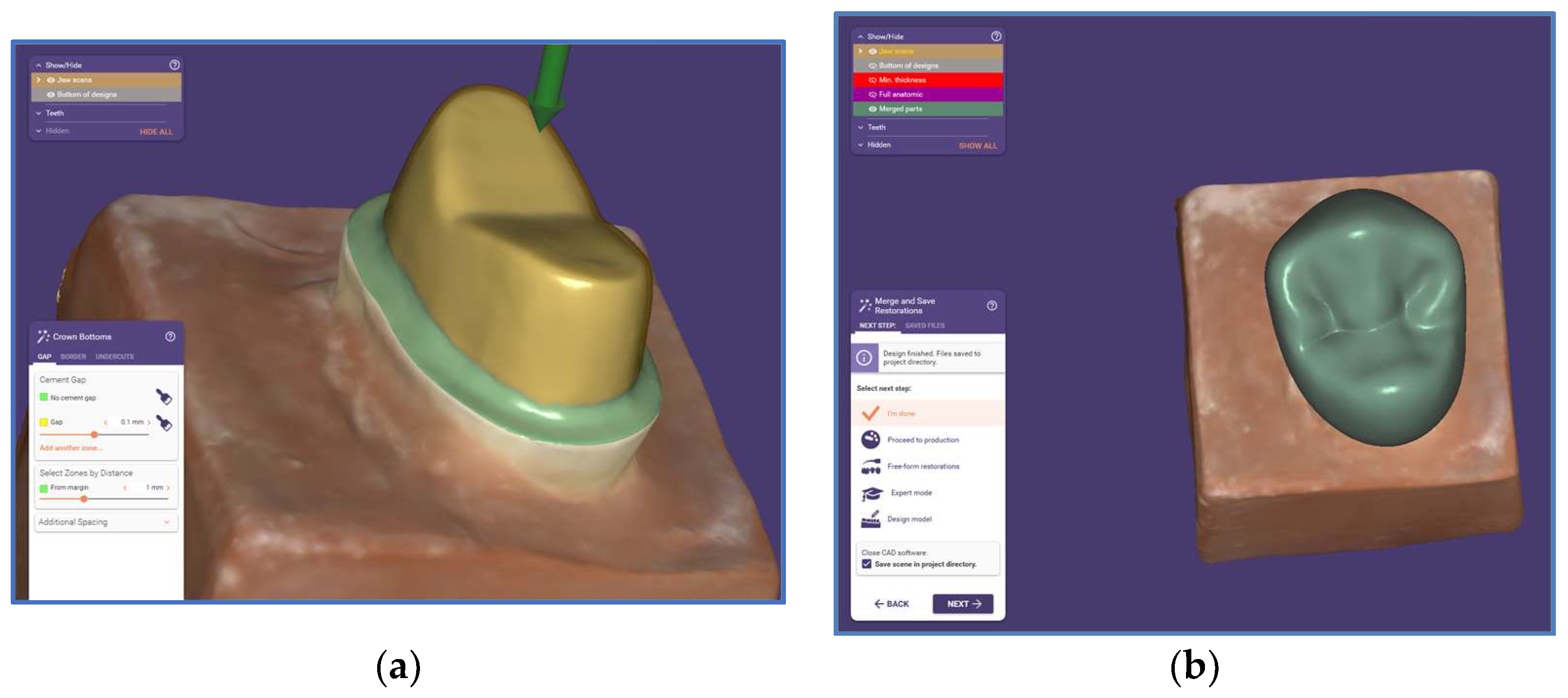 Prosthesis 07 00107 g002 Prosthesis 07 00107 g002