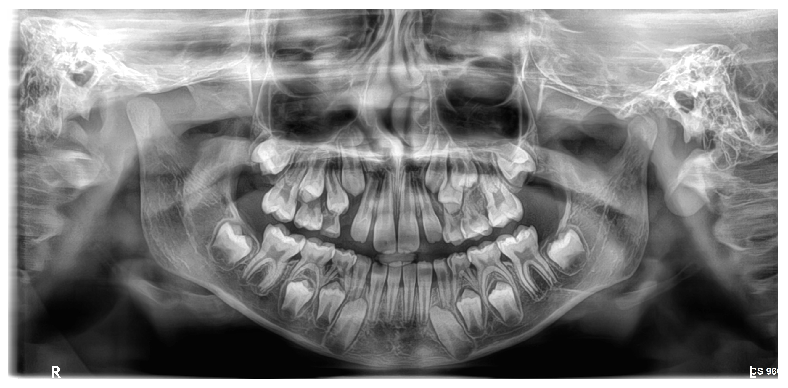 Prosthesis 07 00116 g001 Prosthesis 07 00116 g001