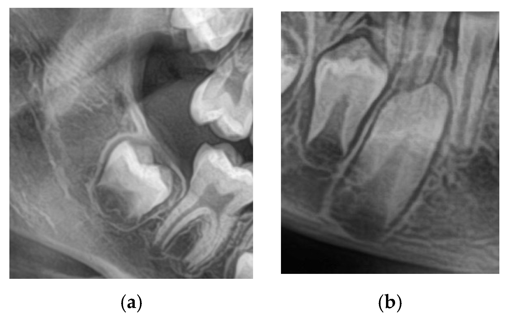 Prosthesis 07 00116 g002 Prosthesis 07 00116 g002