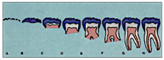 Prosthesis 07 00116 i001 Prosthesis 07 00116 i001