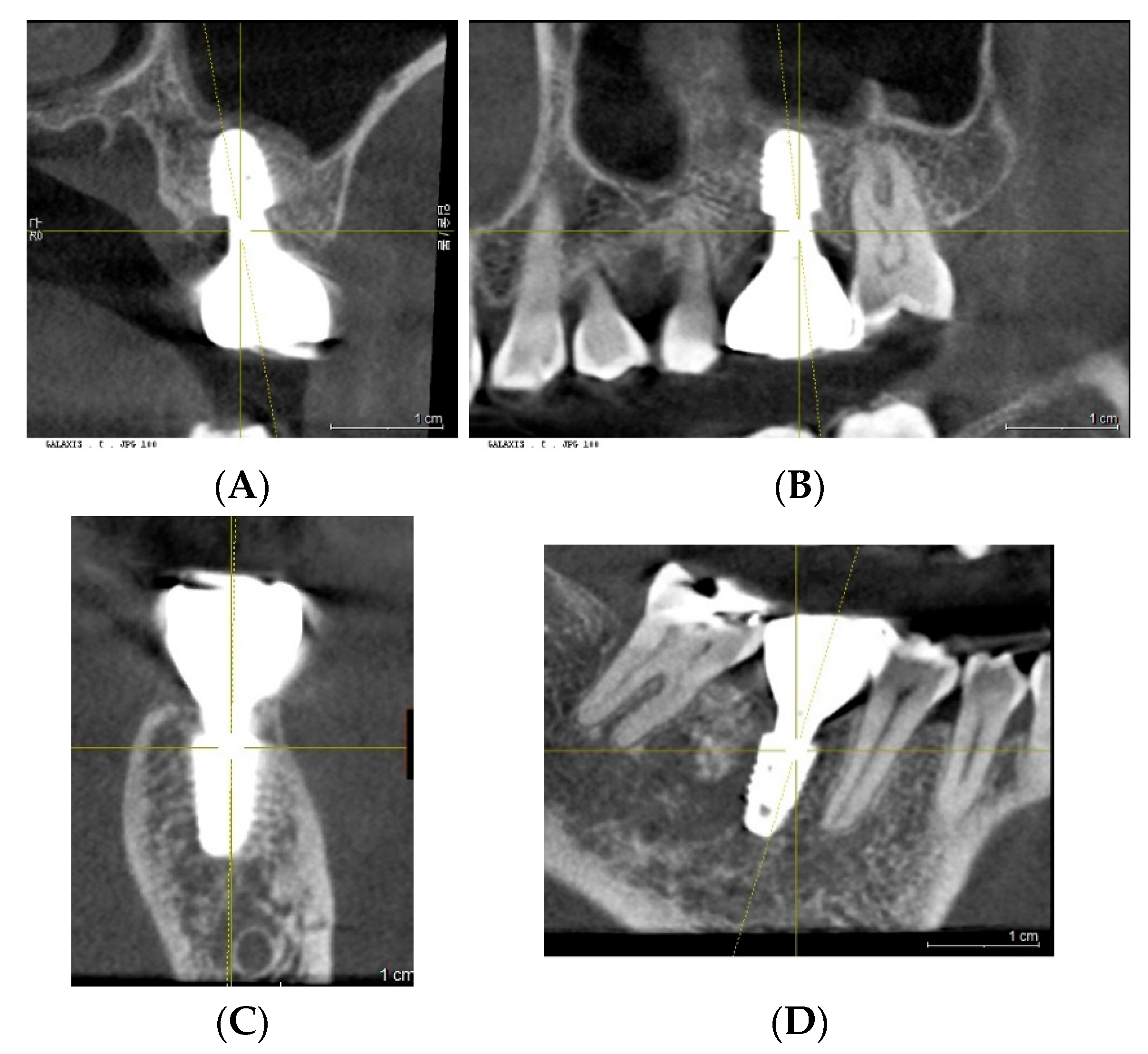 Prosthesis 07 00146 g001 Prosthesis 07 00146 g001