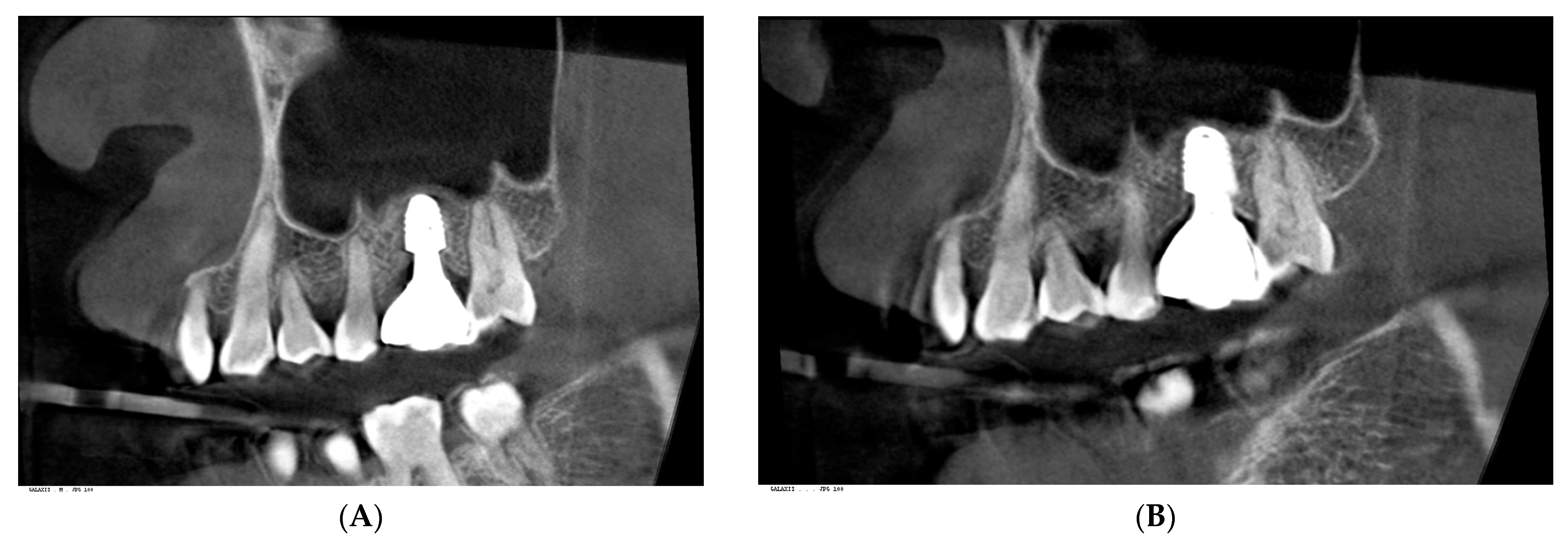 Prosthesis 07 00146 g003a Prosthesis 07 00146 g003a