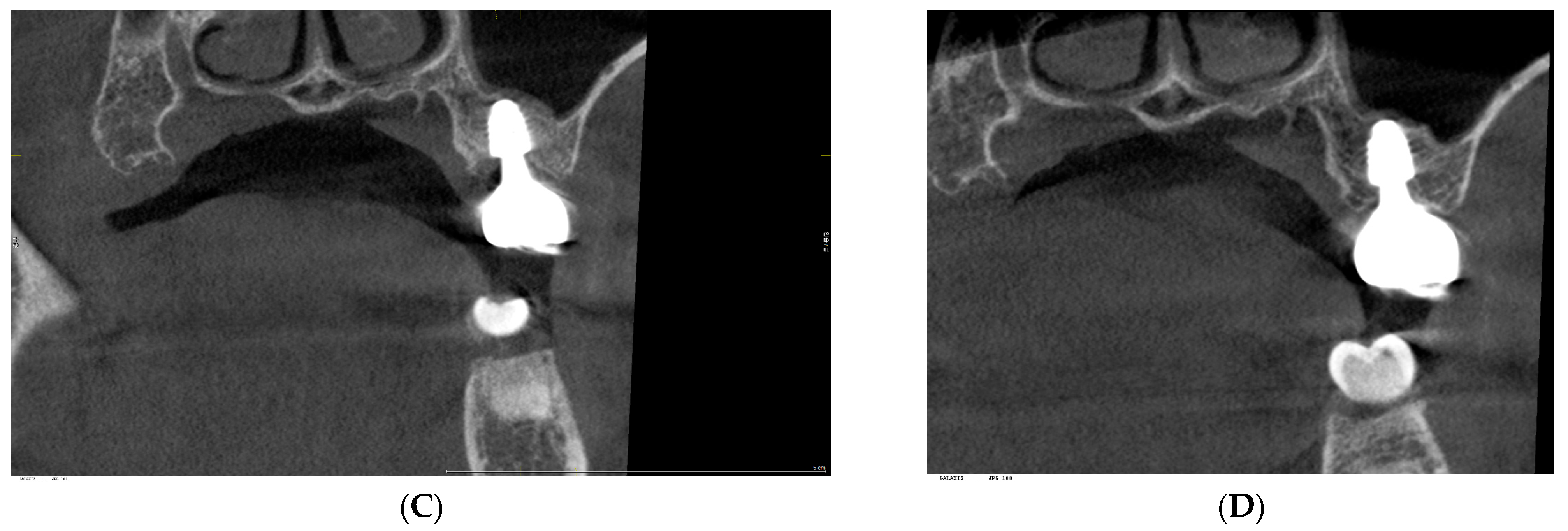 Prosthesis 07 00146 g003b Prosthesis 07 00146 g003b
