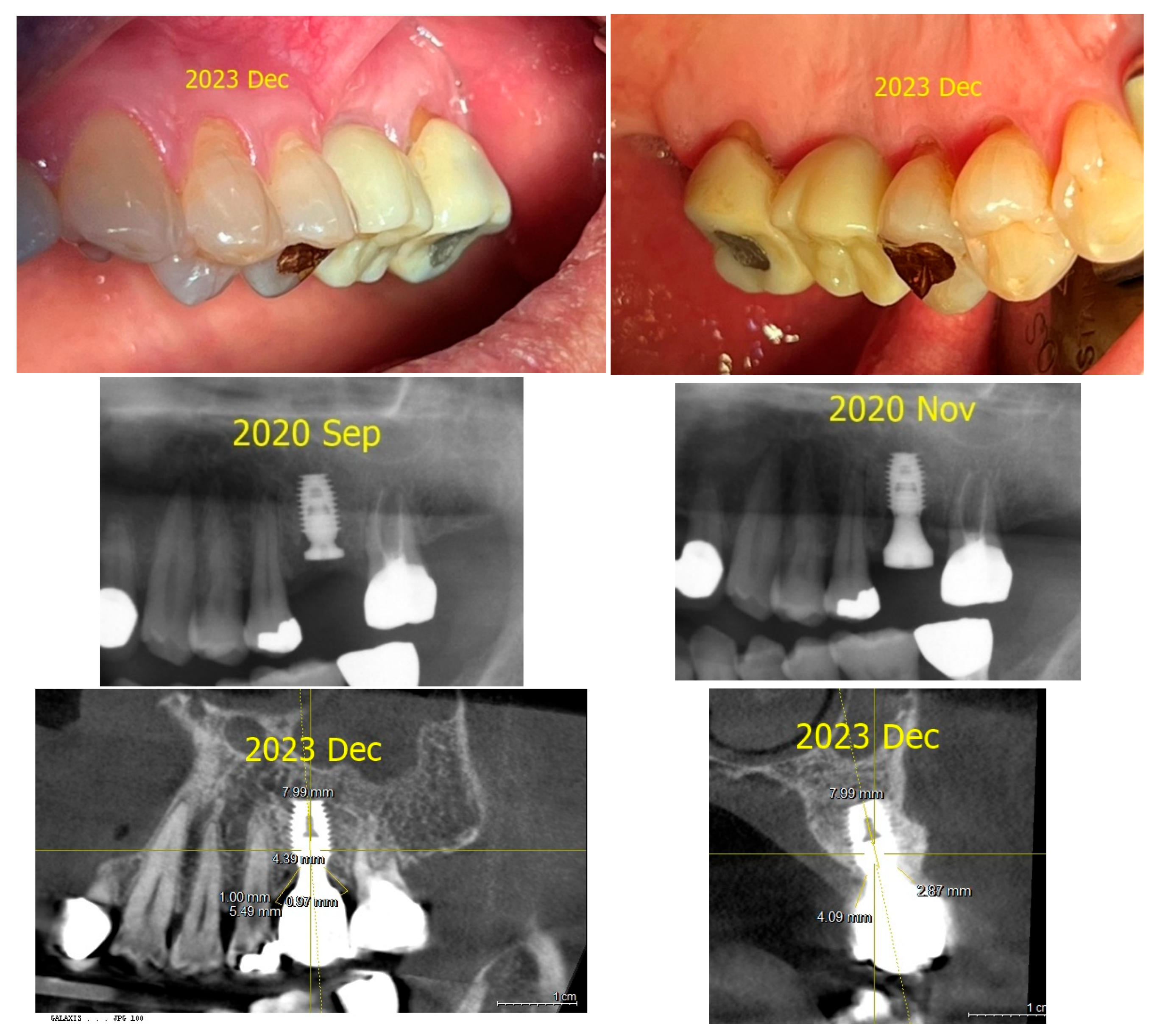Prosthesis 07 00146 g007 Prosthesis 07 00146 g007