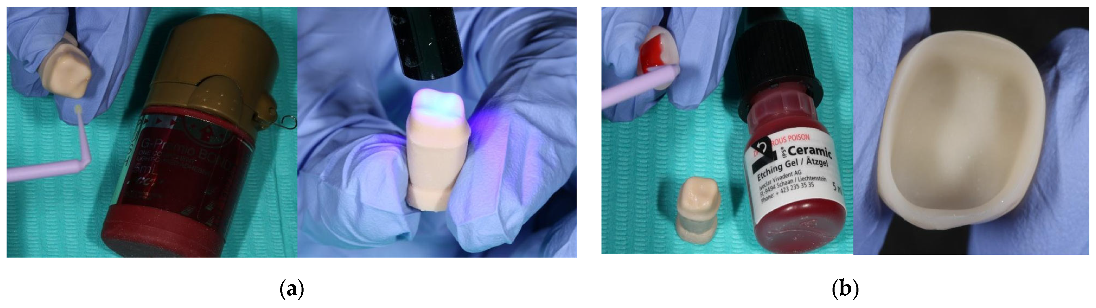 Prosthesis 07 00147 g001 Prosthesis 07 00147 g001