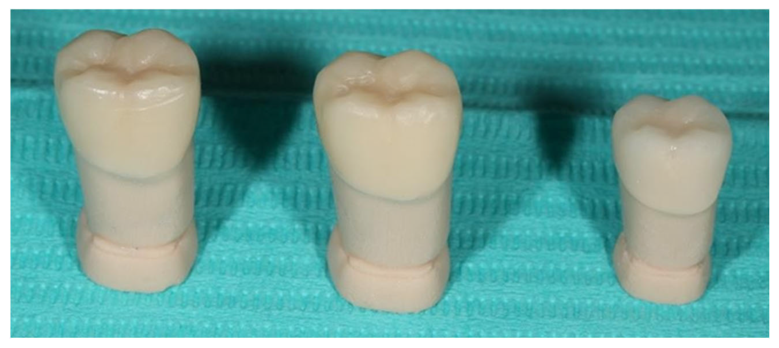 Prosthesis 07 00147 g003 Prosthesis 07 00147 g003