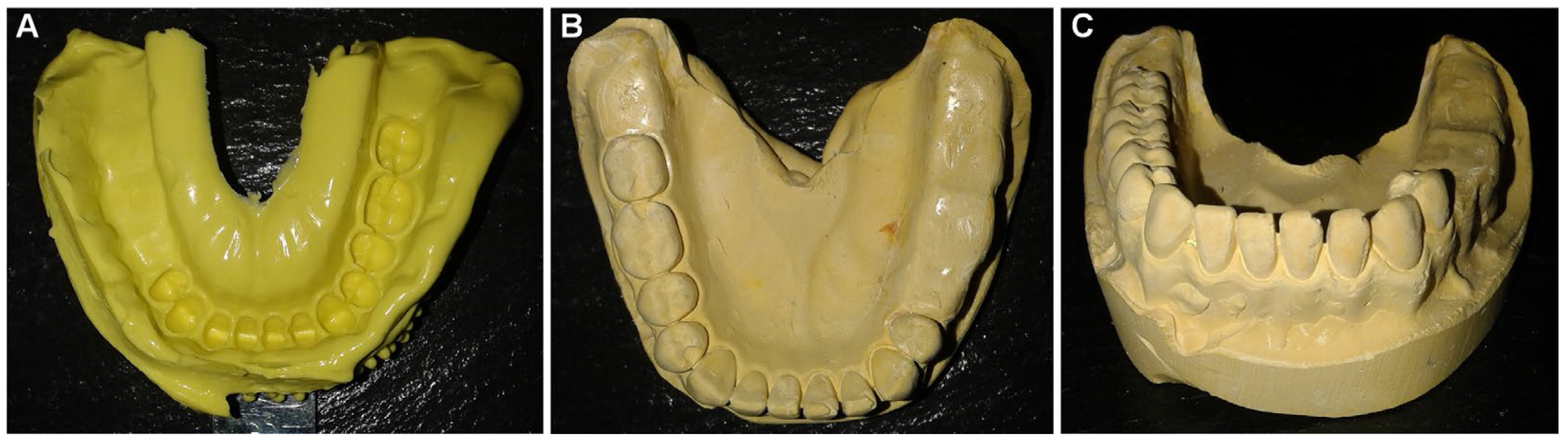 Prosthesis 07 00157 g002 Prosthesis 07 00157 g002