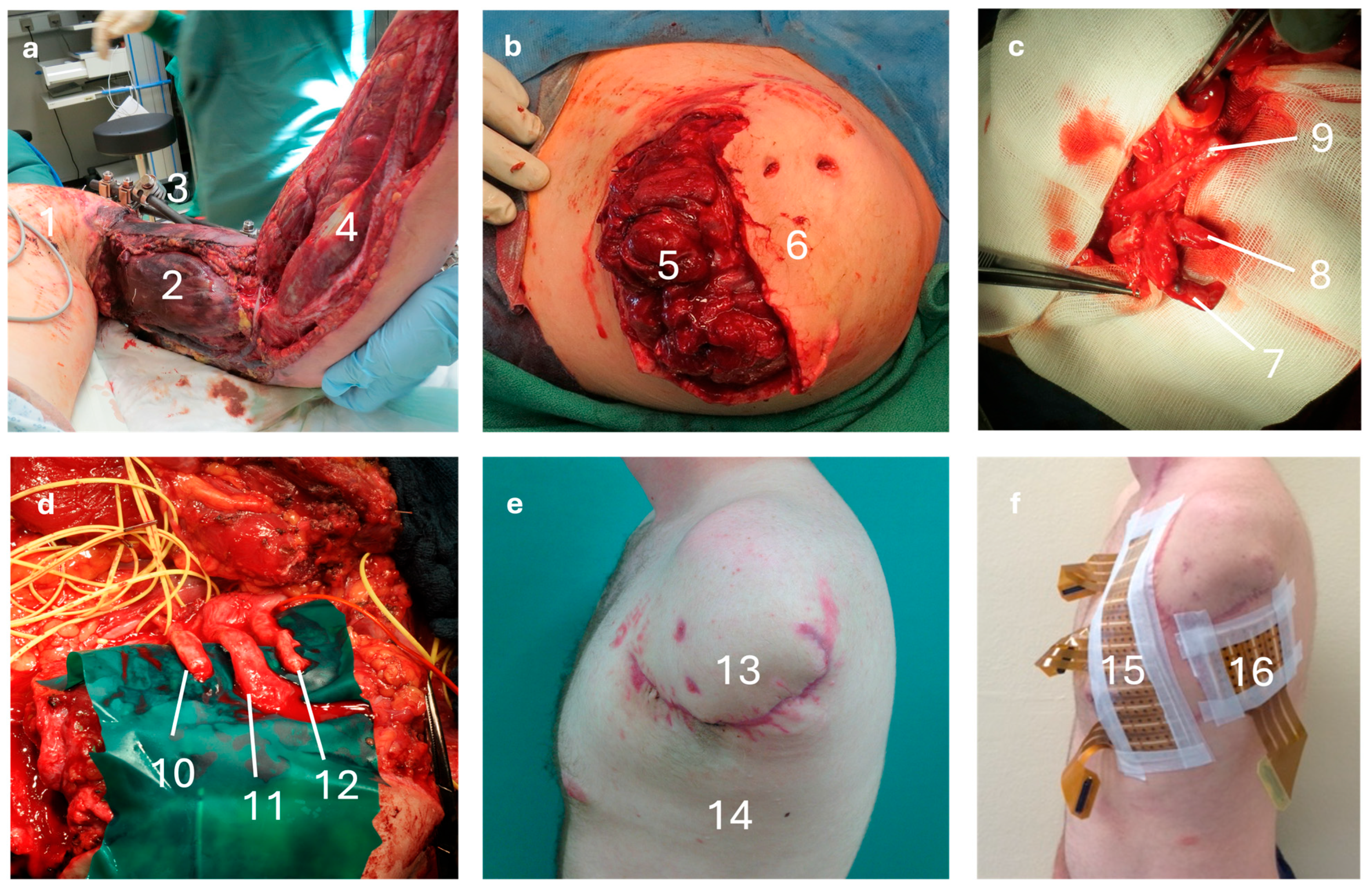 Prosthesis 08 00015 g002 Prosthesis 08 00015 g002